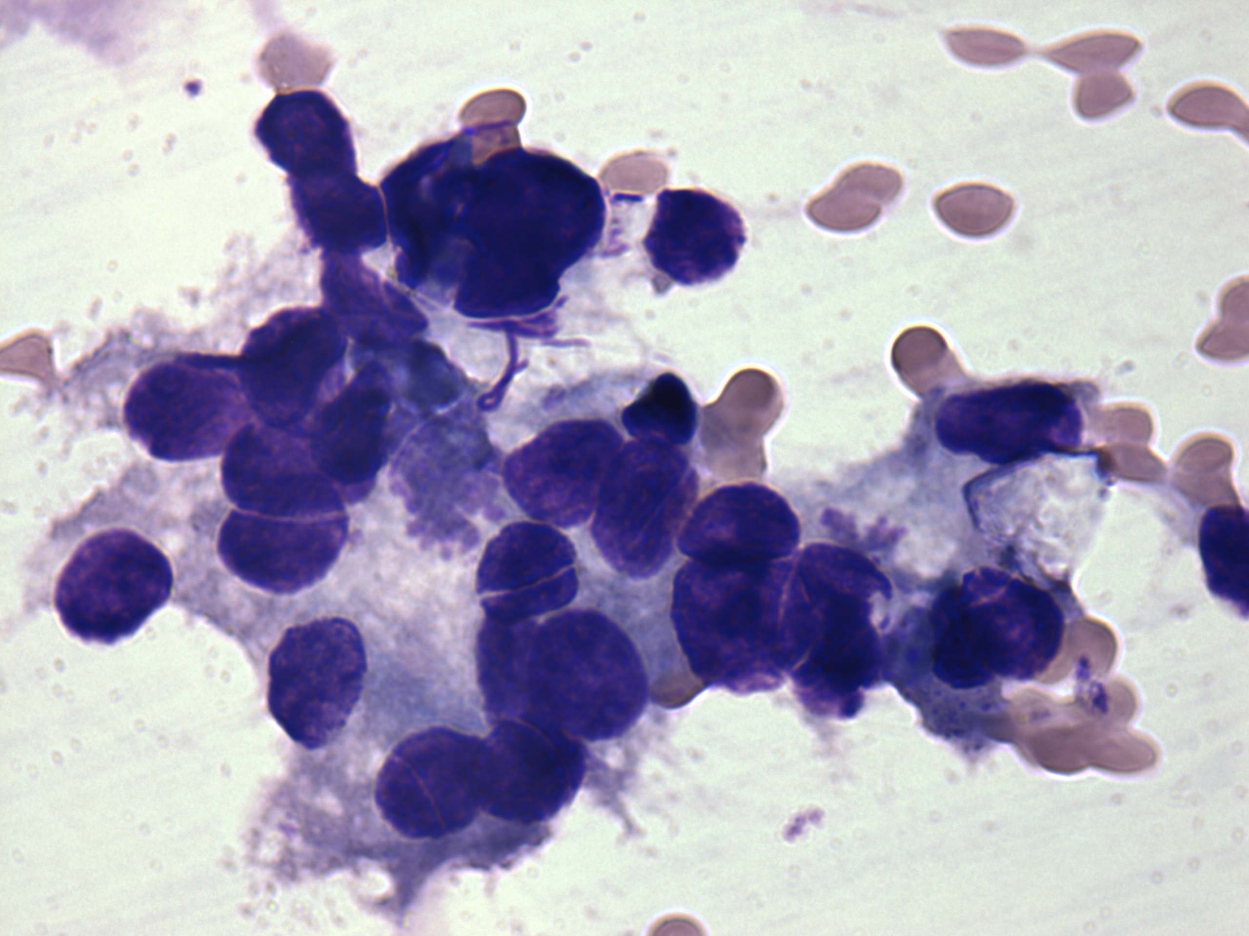 Right lobe, longitudinal scan