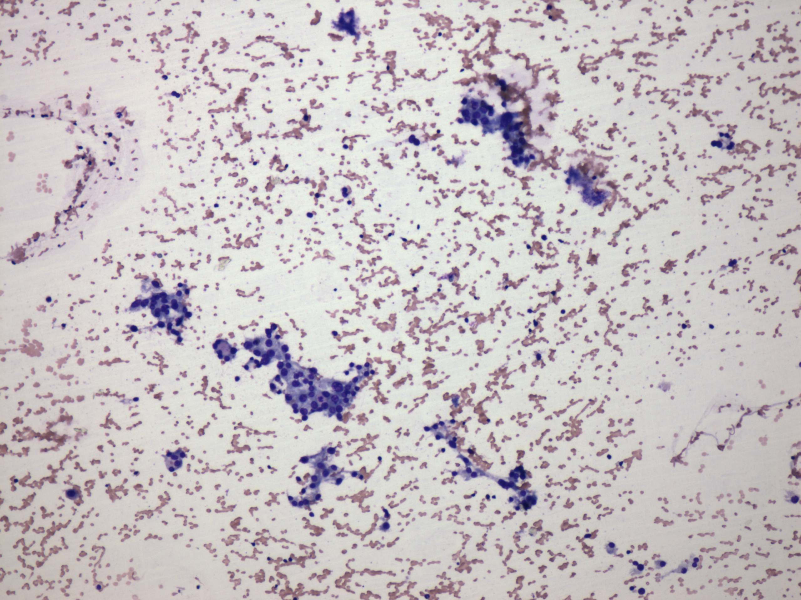 Right lobe, longitudinal scan