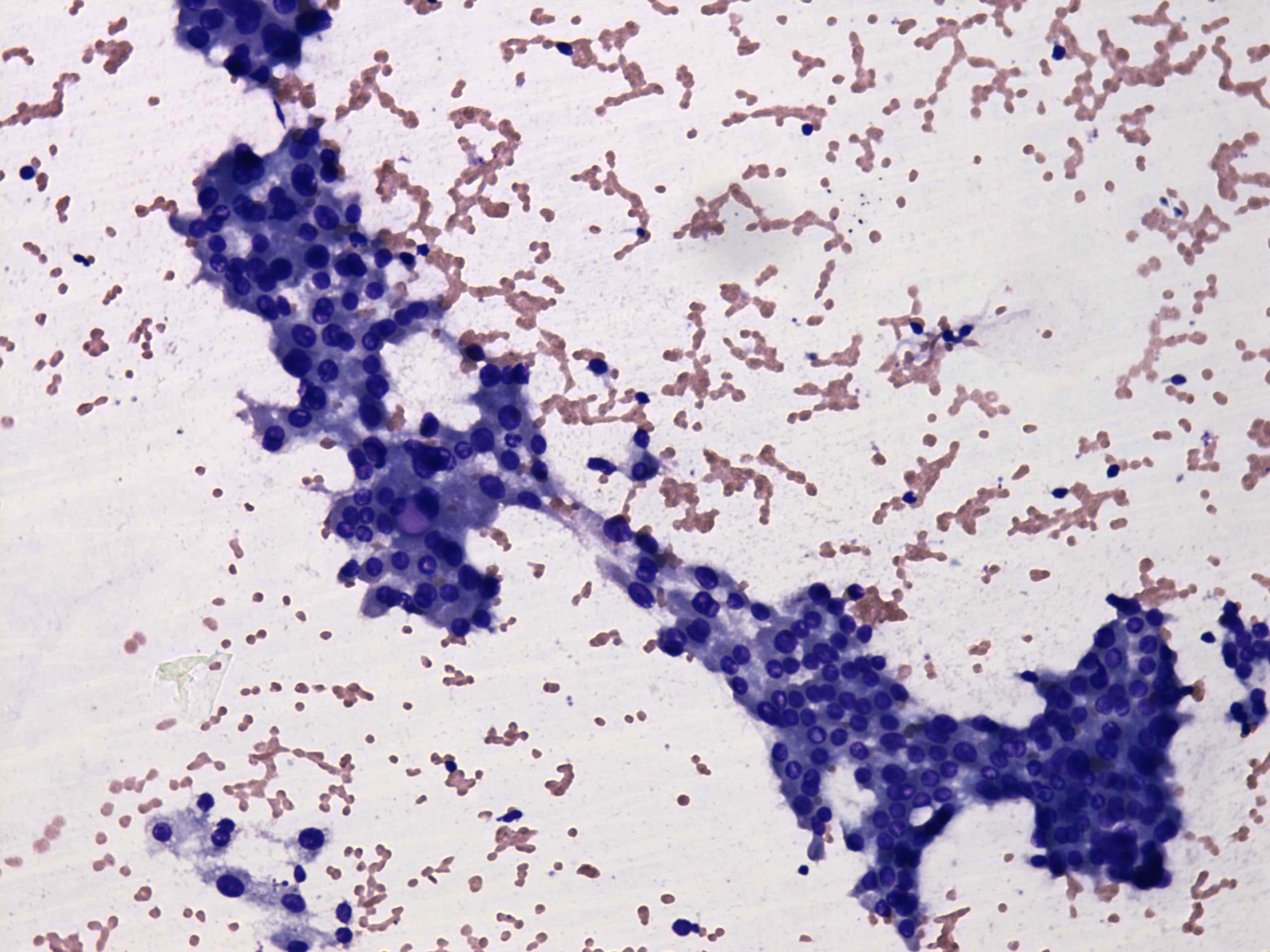 Right lobe, longitudinal scan