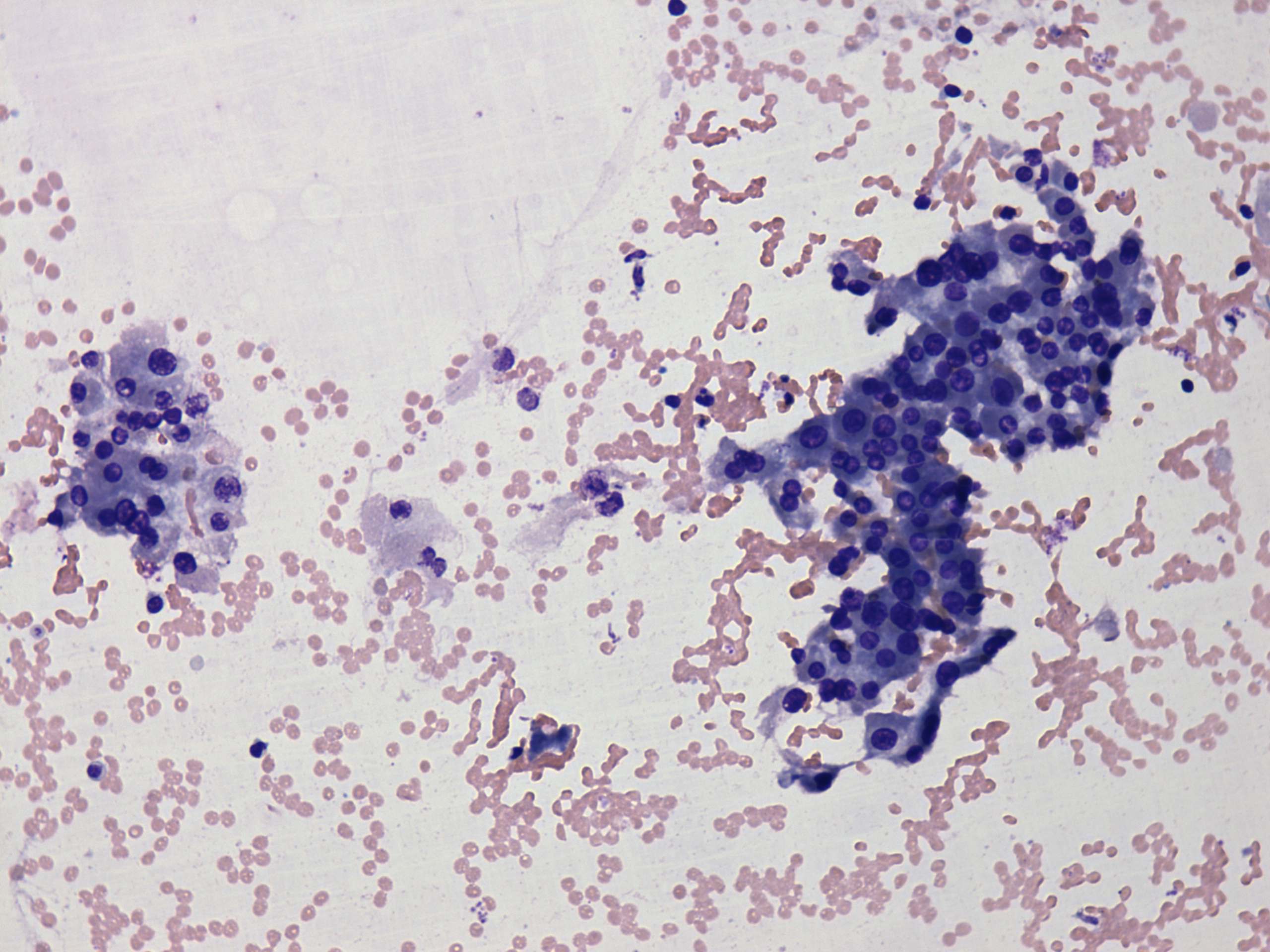 Right lobe, longitudinal scan
