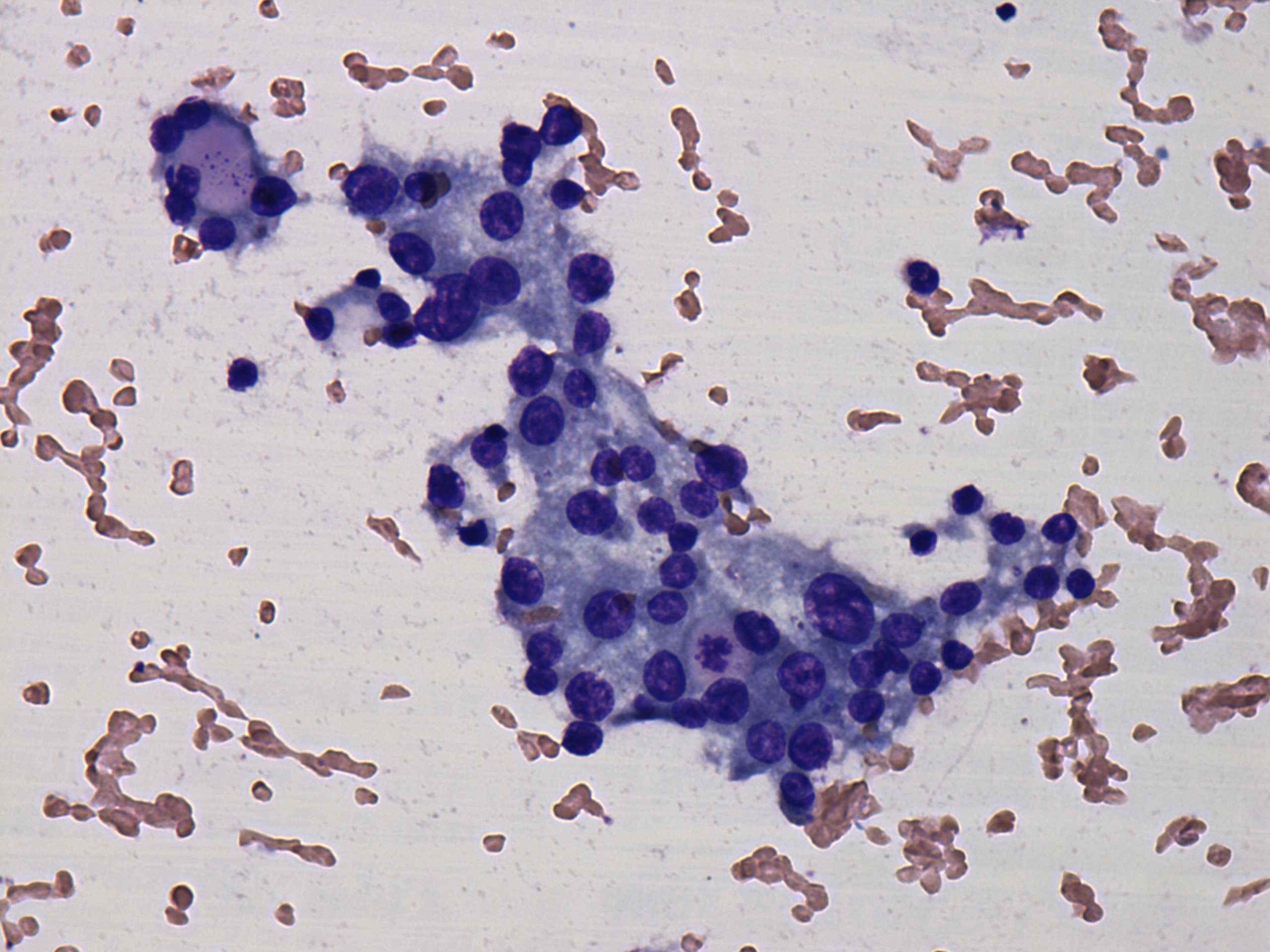 Right lobe, longitudinal scan