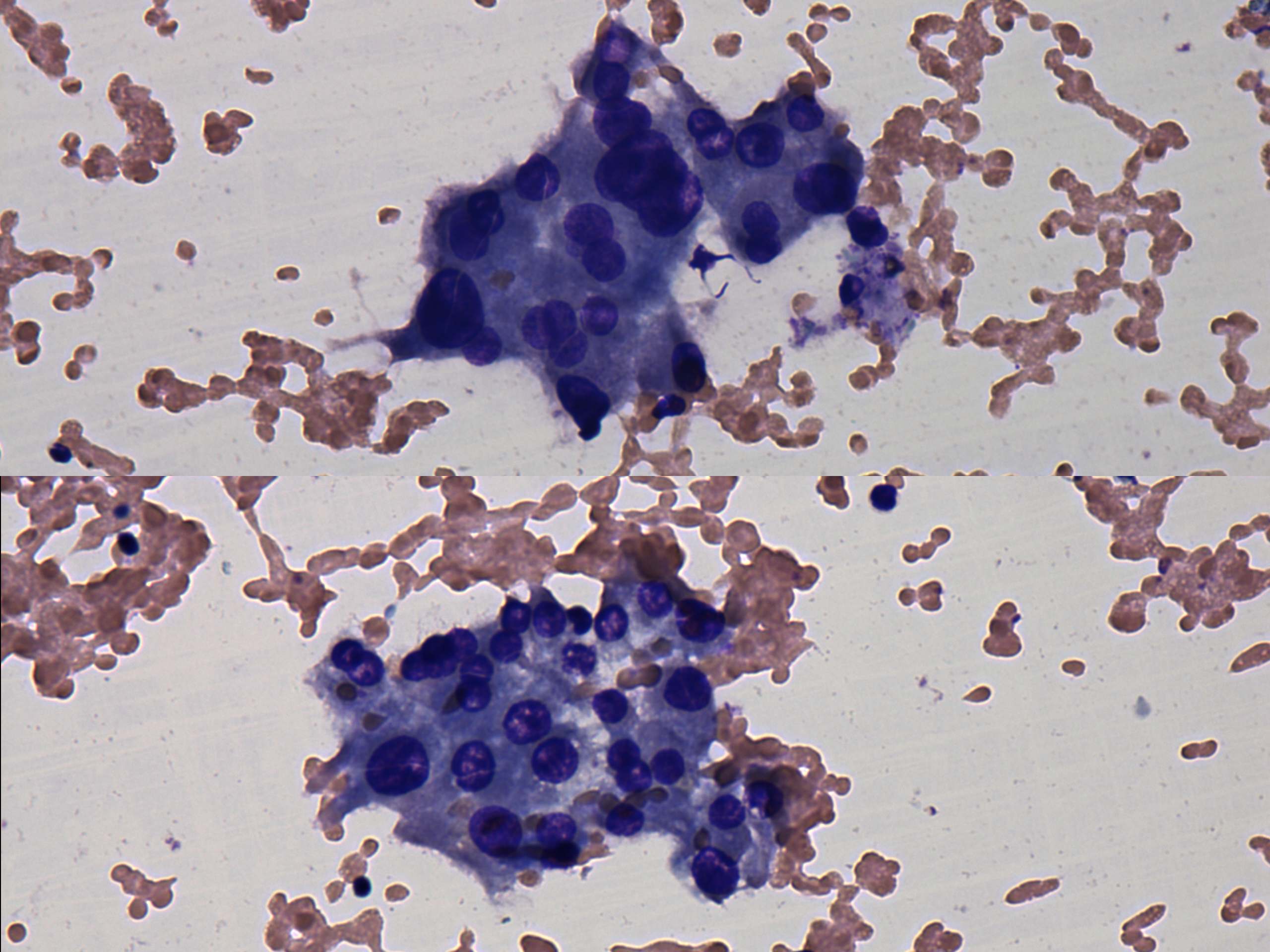 Right lobe, longitudinal scan