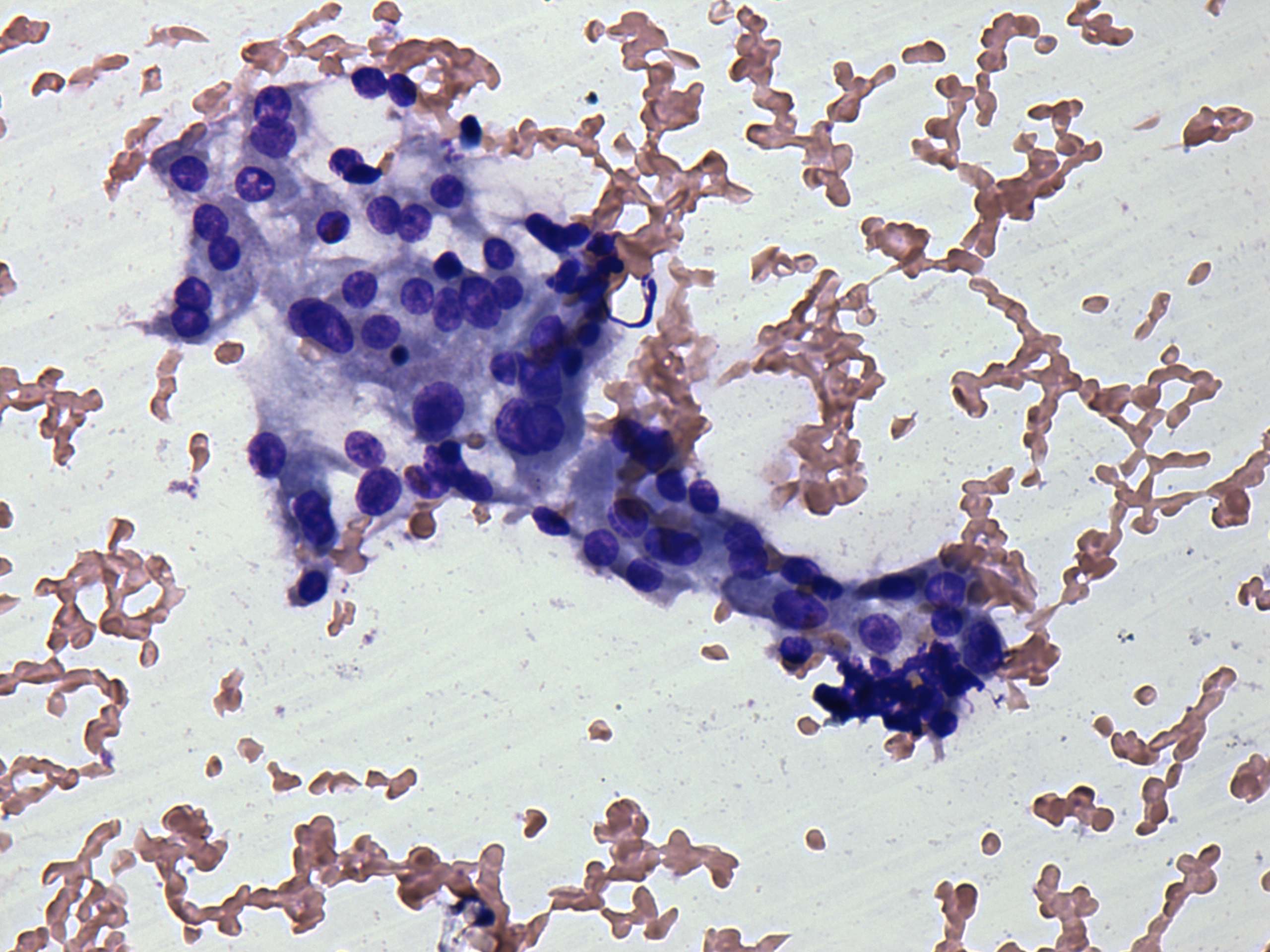 Right lobe, longitudinal scan