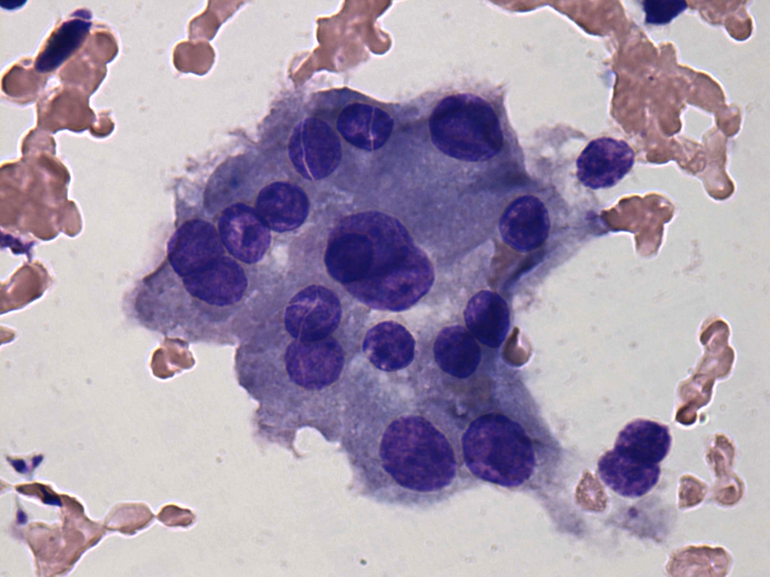 Right lobe, longitudinal scan