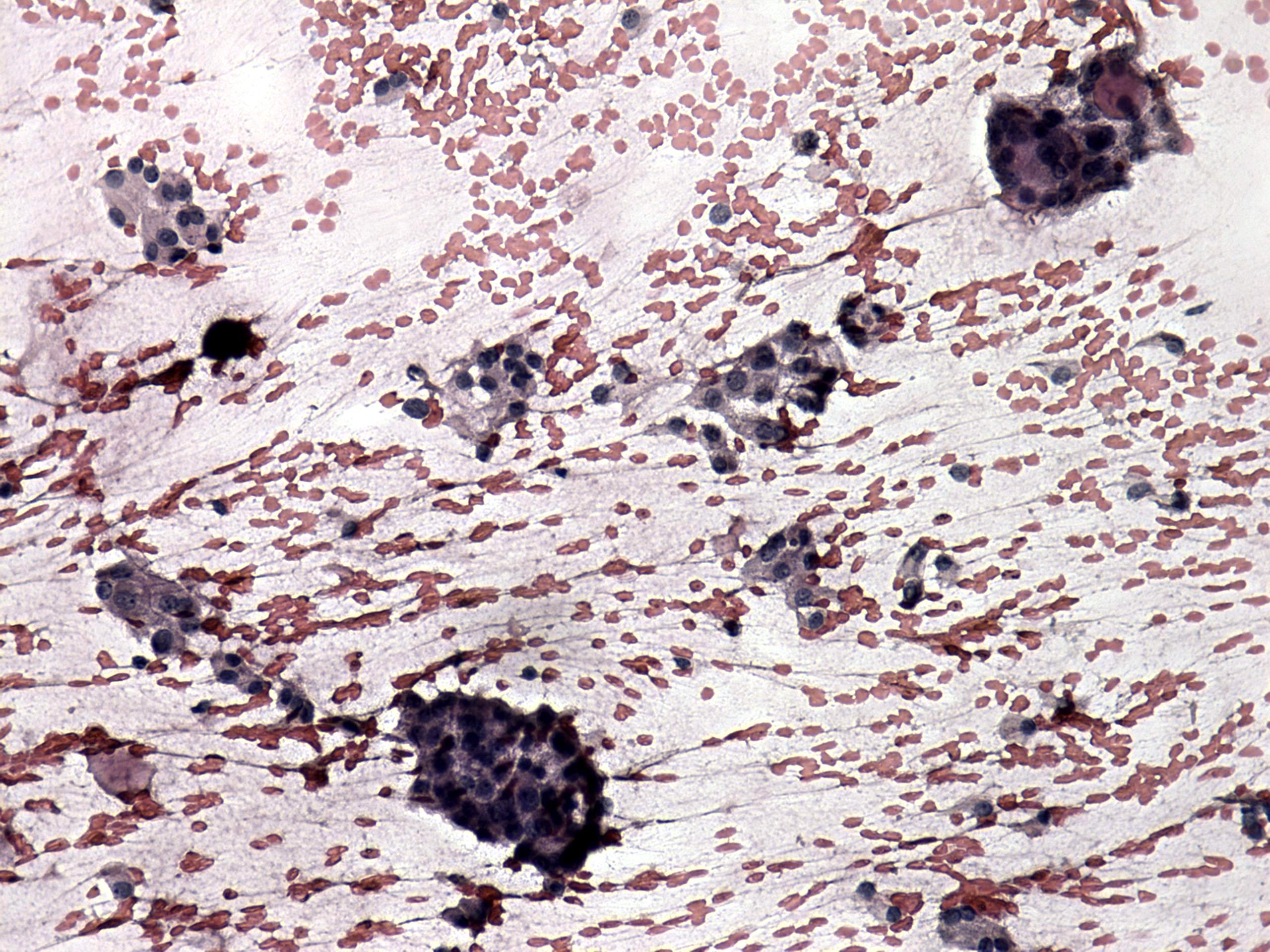 Right lobe, longitudinal scan