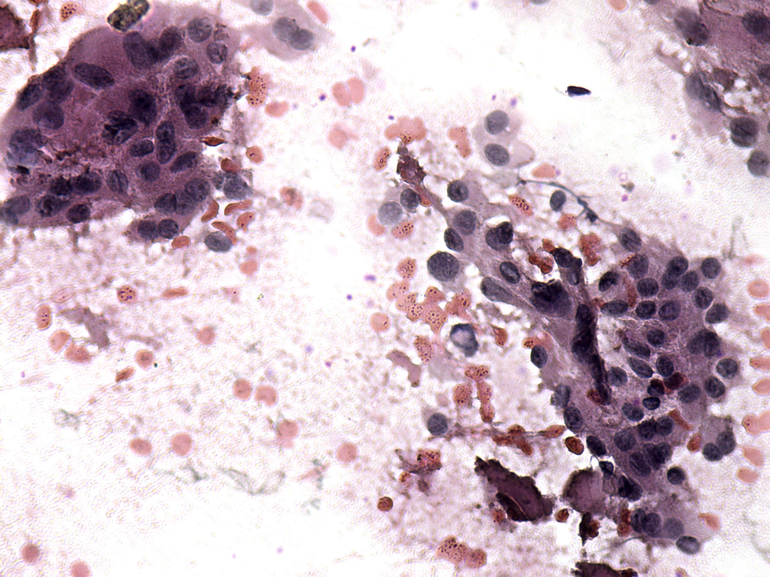 Right lobe, longitudinal scan