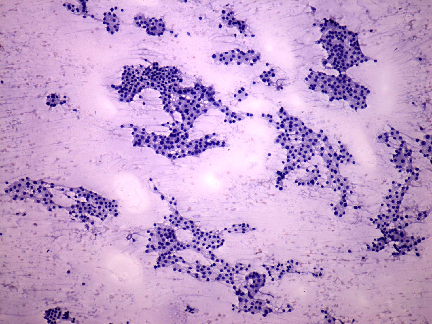Right lobe, longitudinal scan