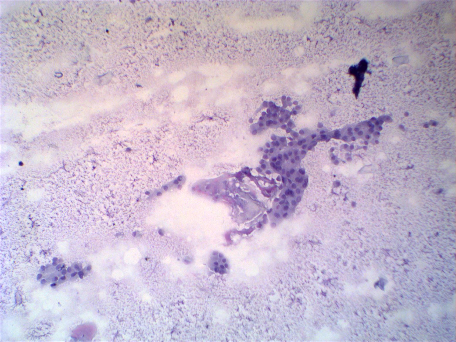Right lobe, longitudinal scan