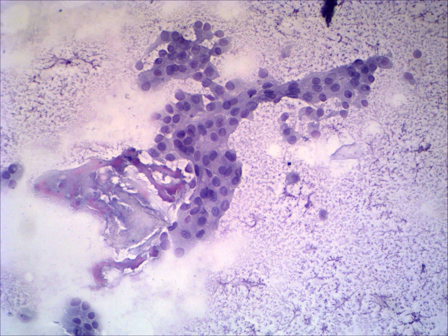 Right lobe, longitudinal scan
