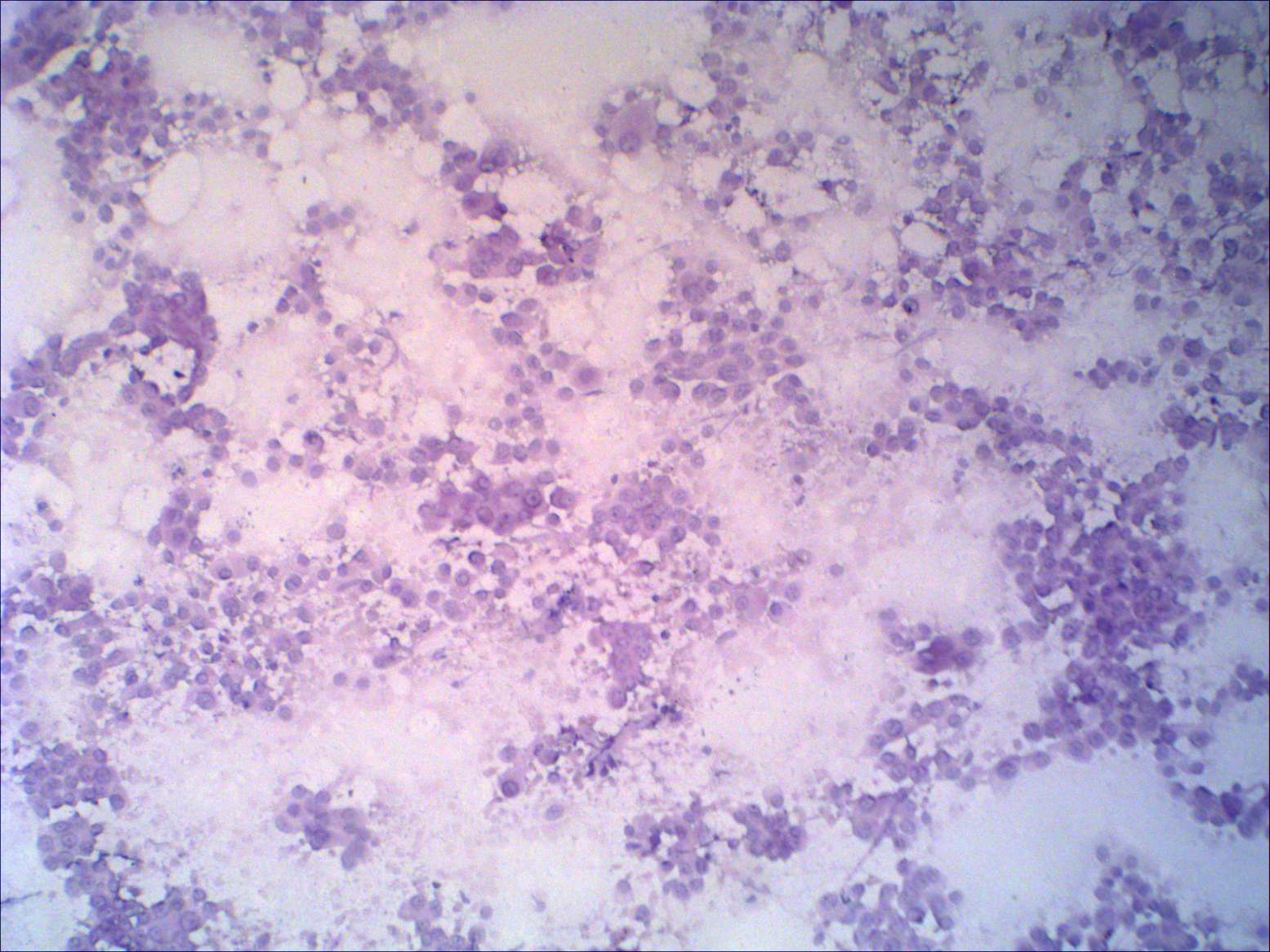 Right lobe, longitudinal scan