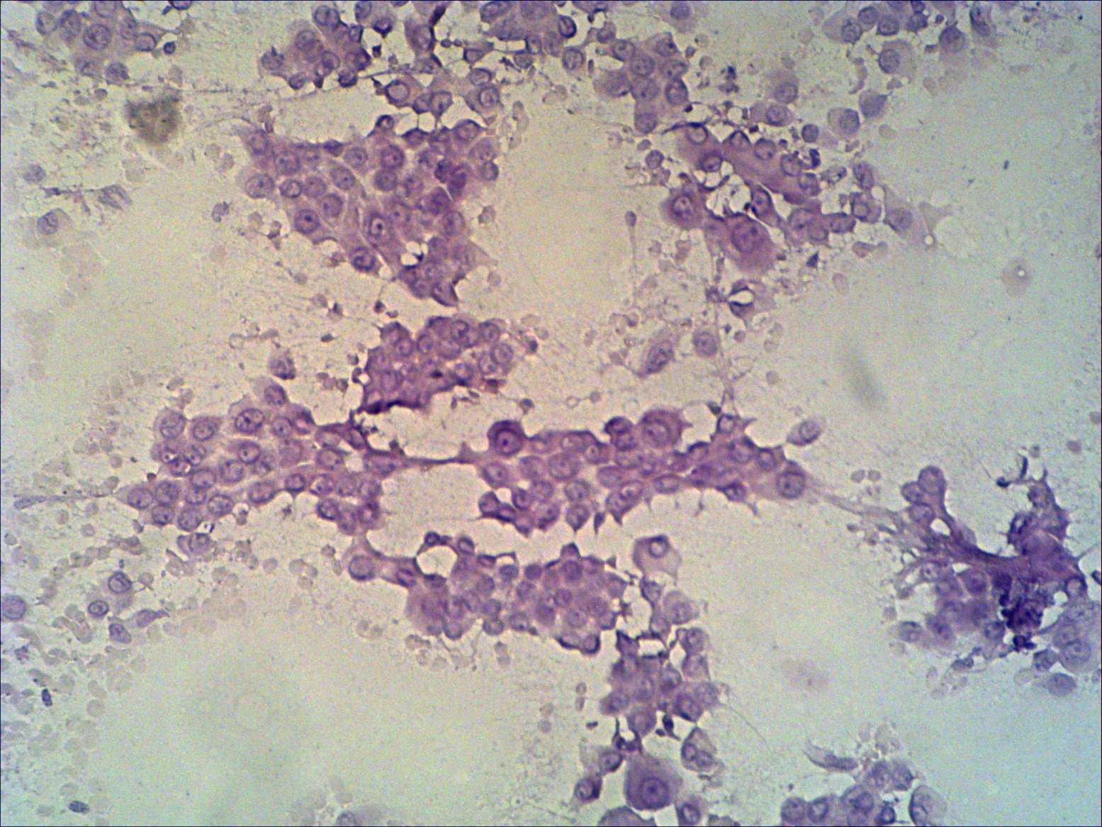 Right lobe, longitudinal scan