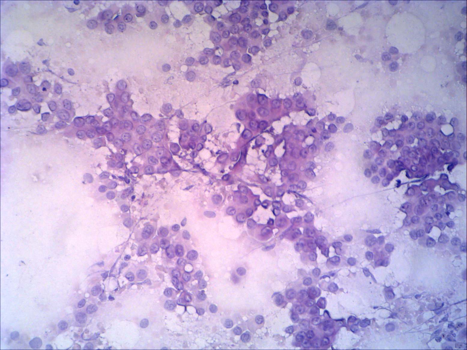 Right lobe, longitudinal scan