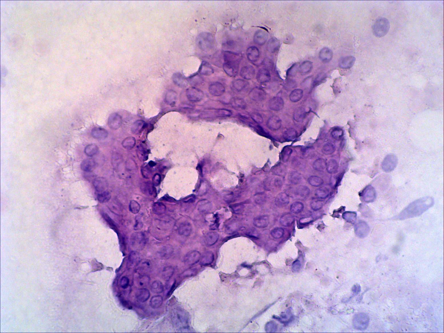 Right lobe, longitudinal scan