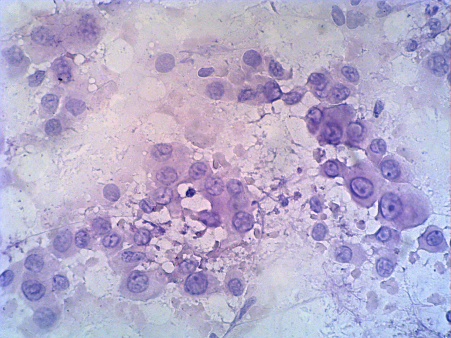 Right lobe, longitudinal scan