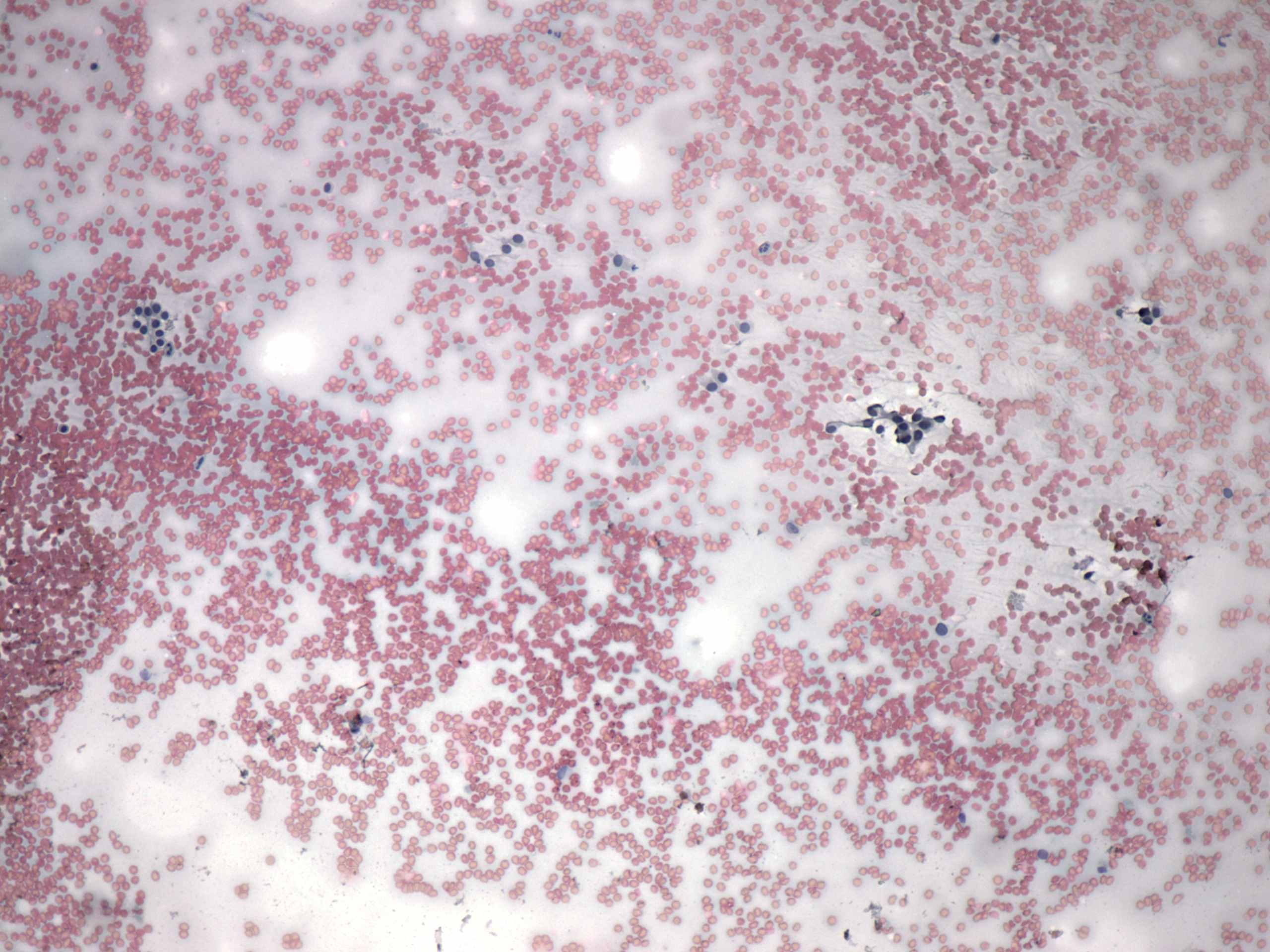 Right lobe, longitudinal scan