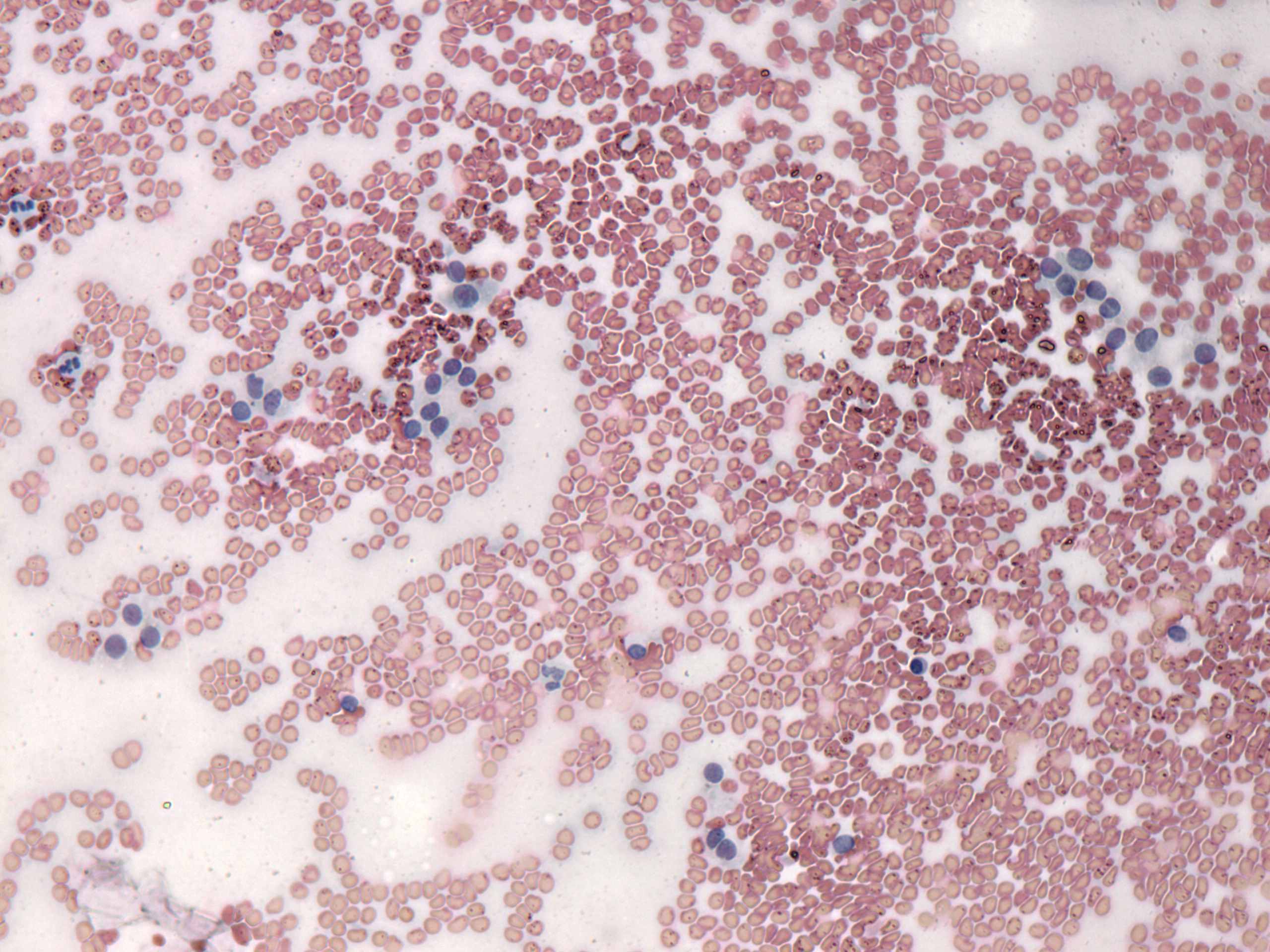 Right lobe, longitudinal scan