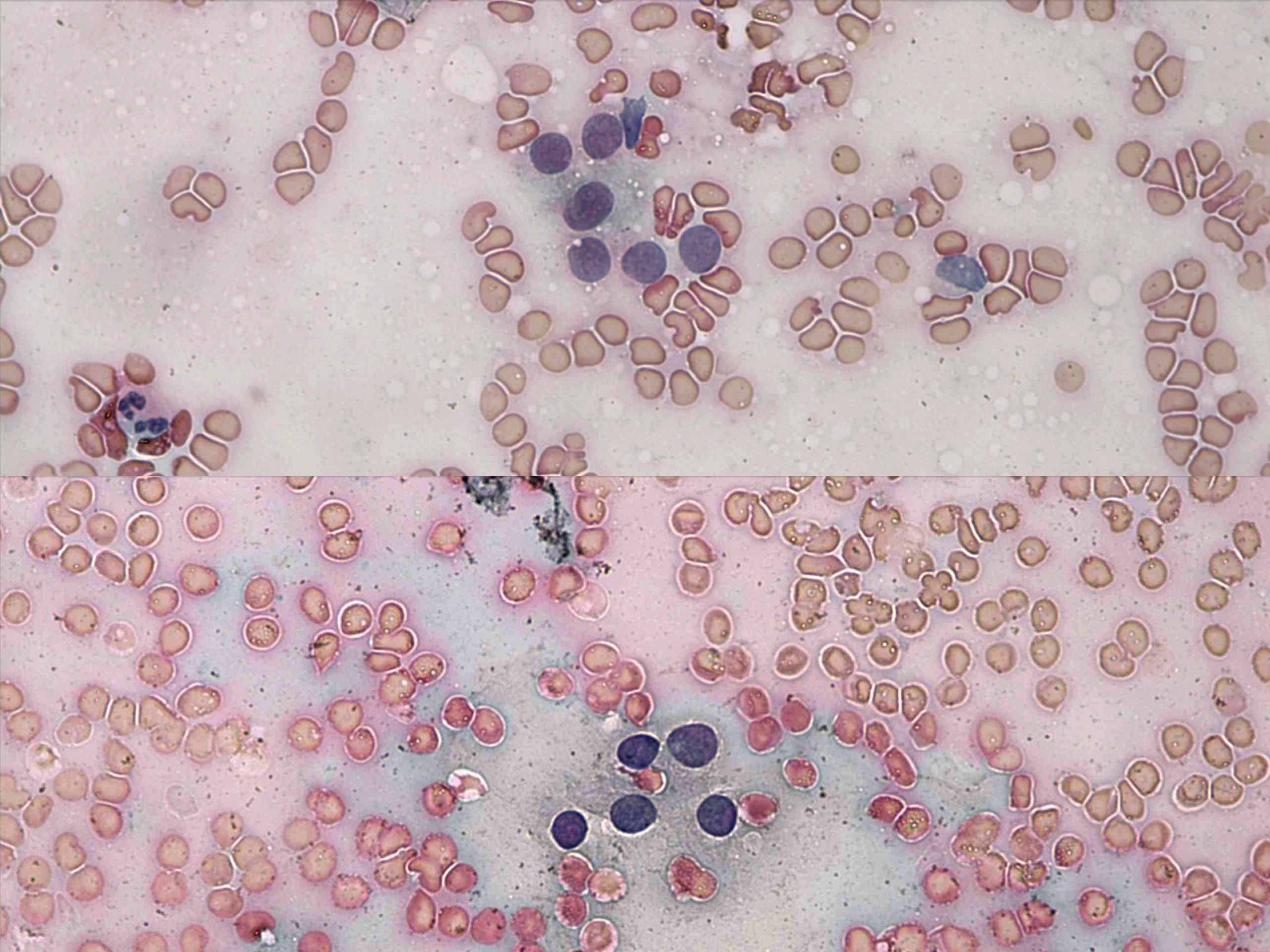 Right lobe, longitudinal scan