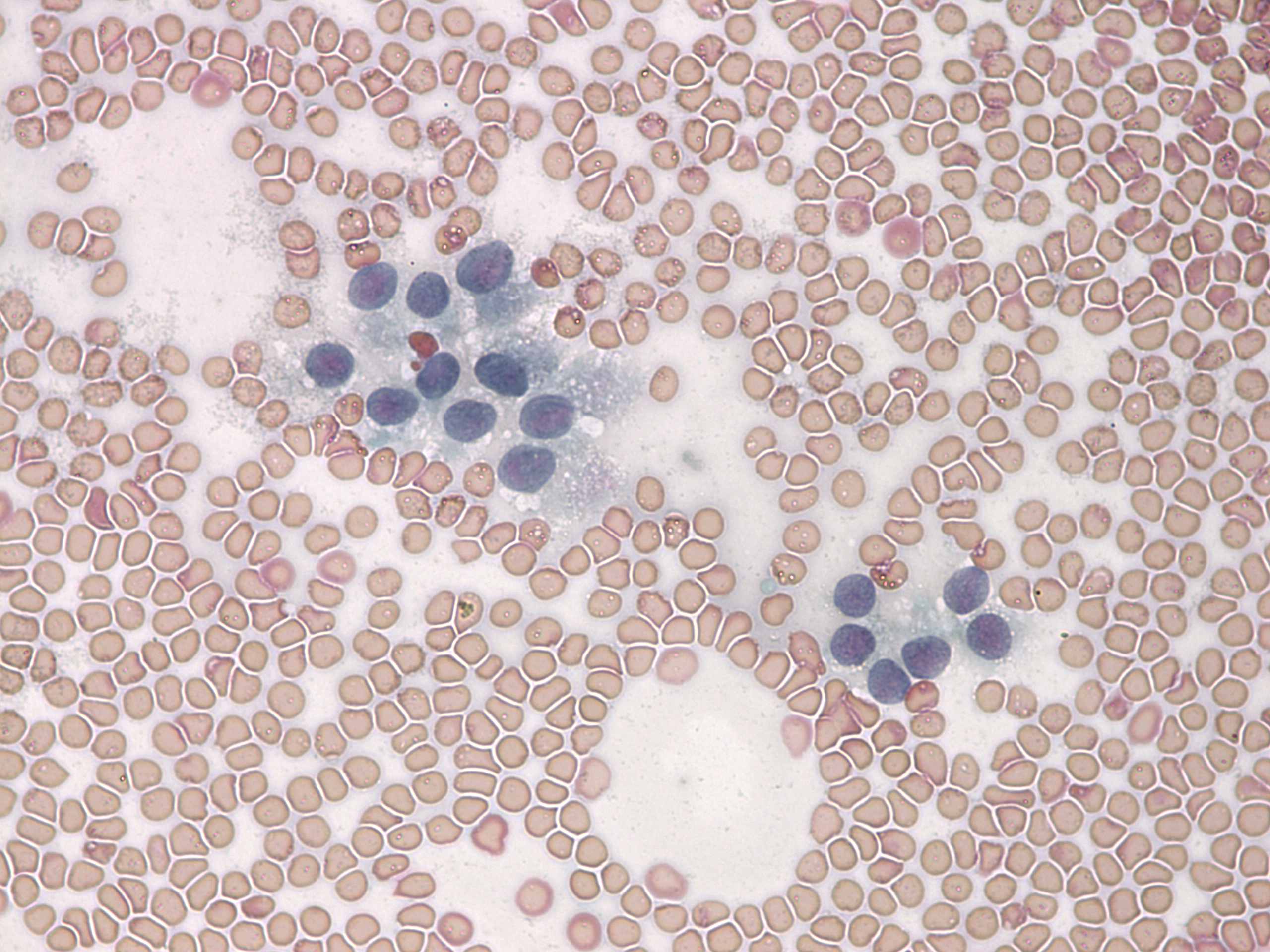 Right lobe, longitudinal scan