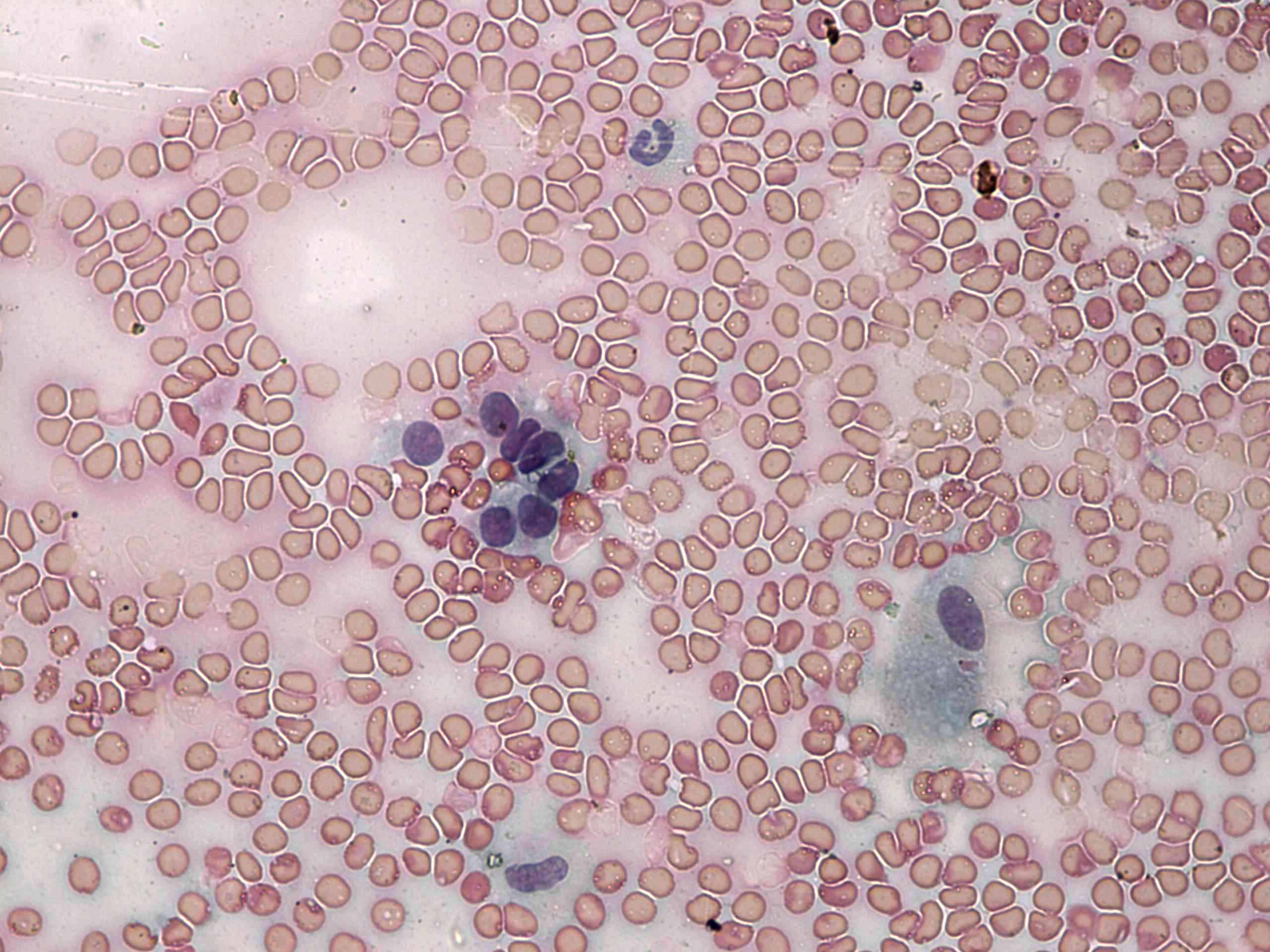 Right lobe, longitudinal scan