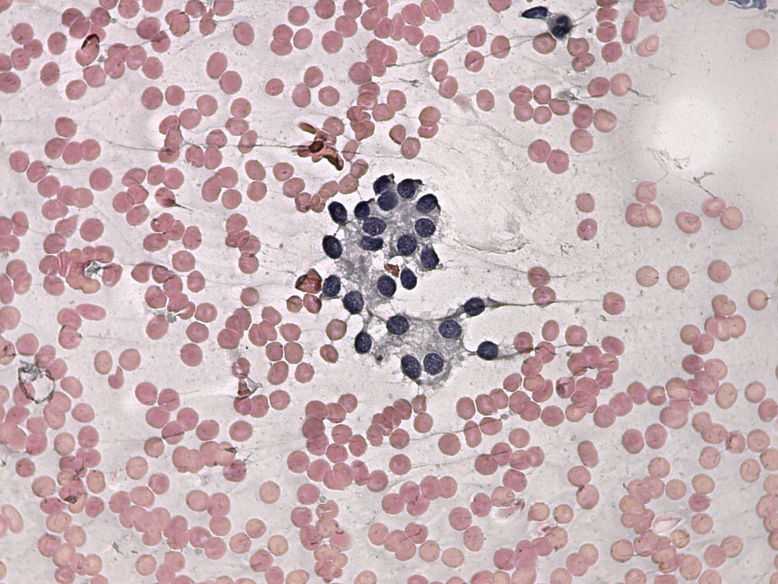 Right lobe, longitudinal scan