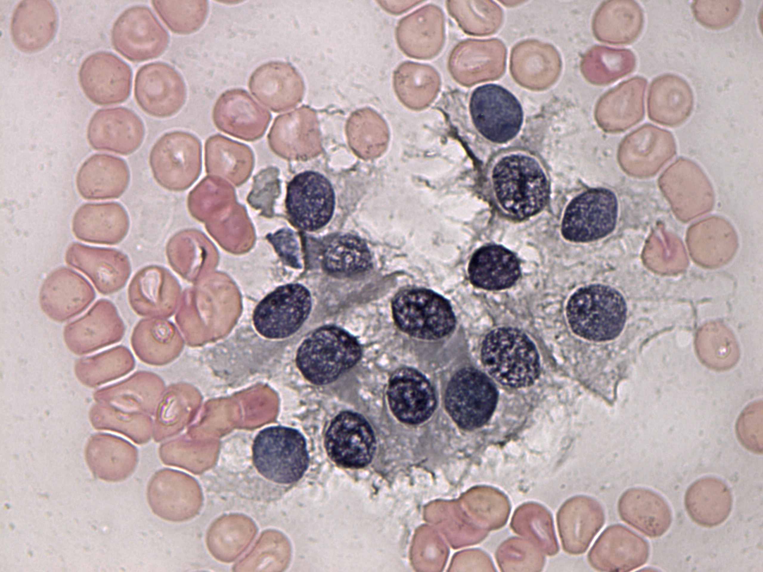Right lobe, longitudinal scan