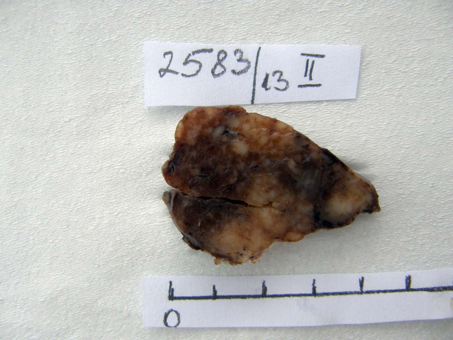 Right lobe, longitudinal scan