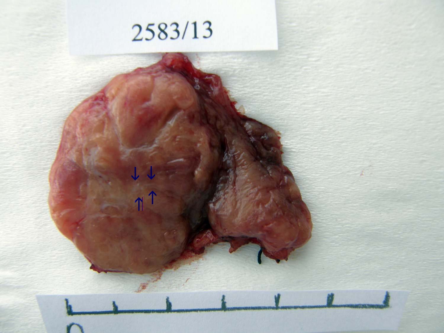 Right lobe, longitudinal scan