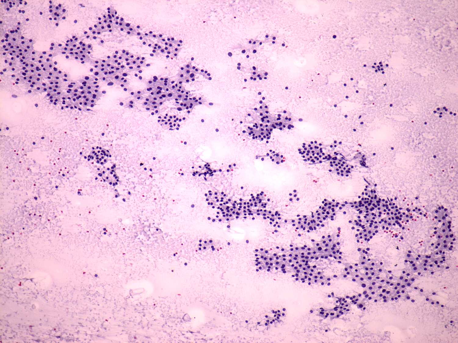 Right lobe, longitudinal scan