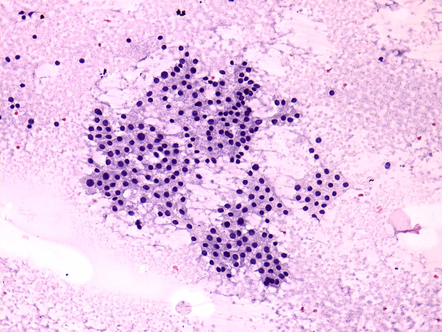 Right lobe, longitudinal scan