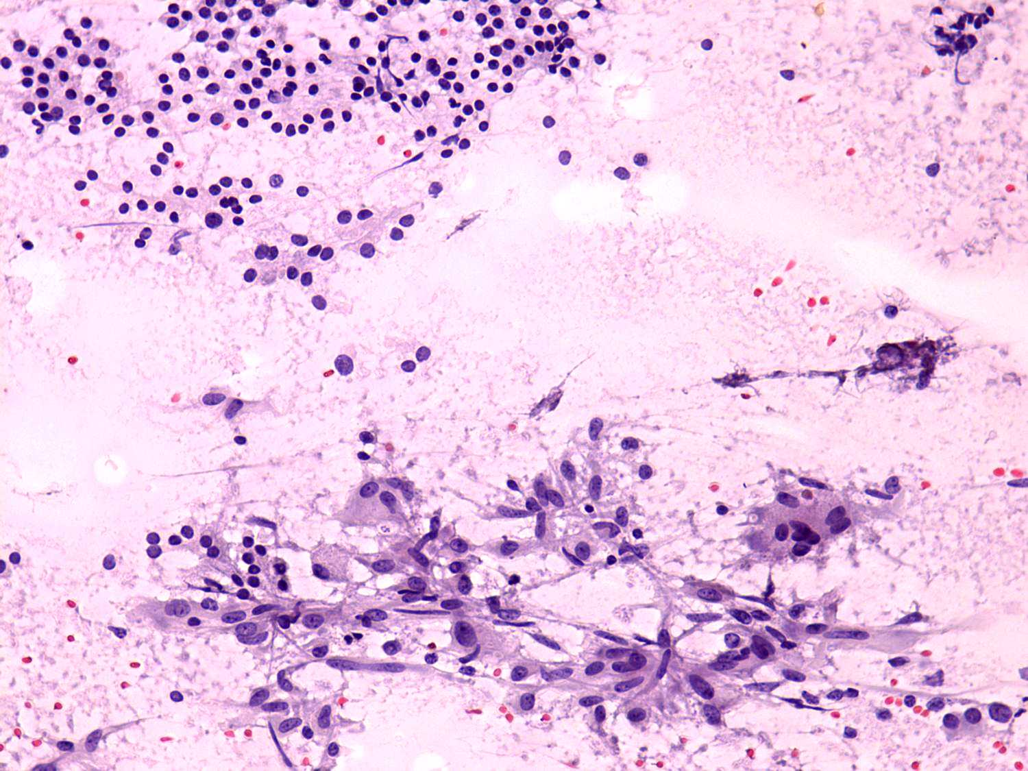 Right lobe, longitudinal scan