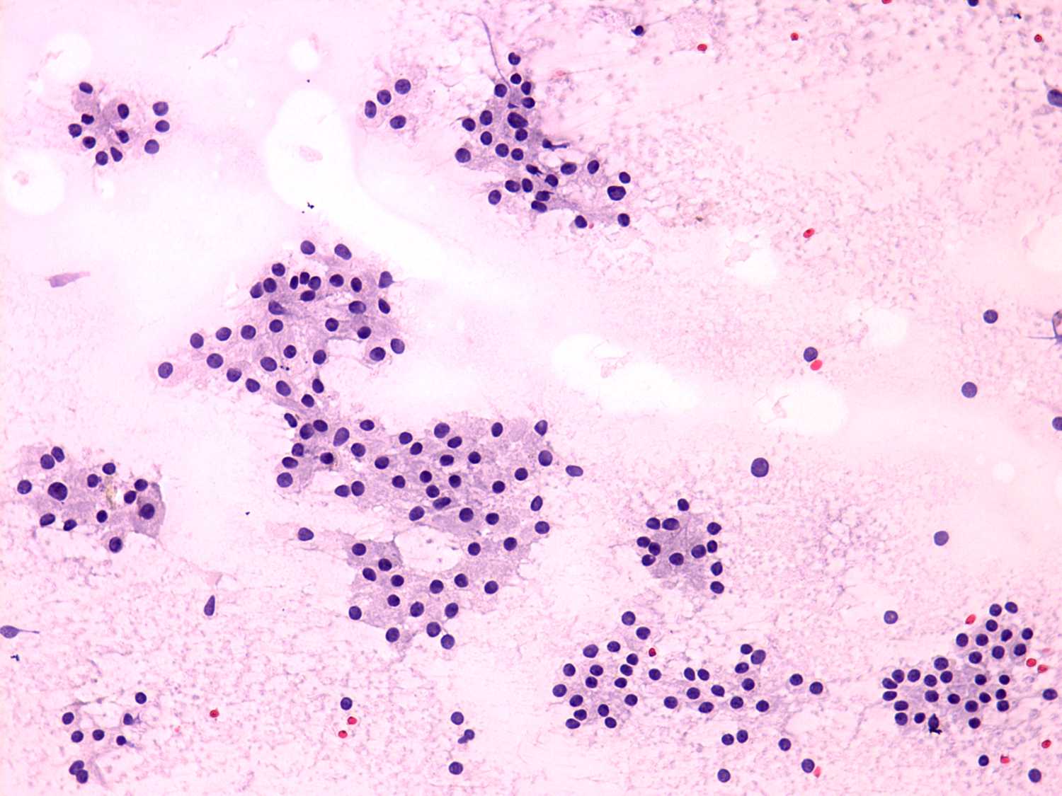 Right lobe, longitudinal scan