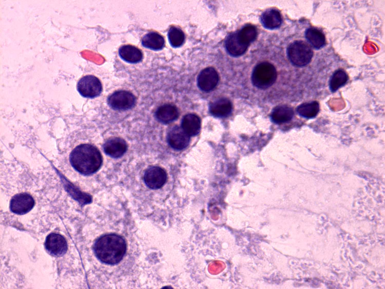 Right lobe, longitudinal scan