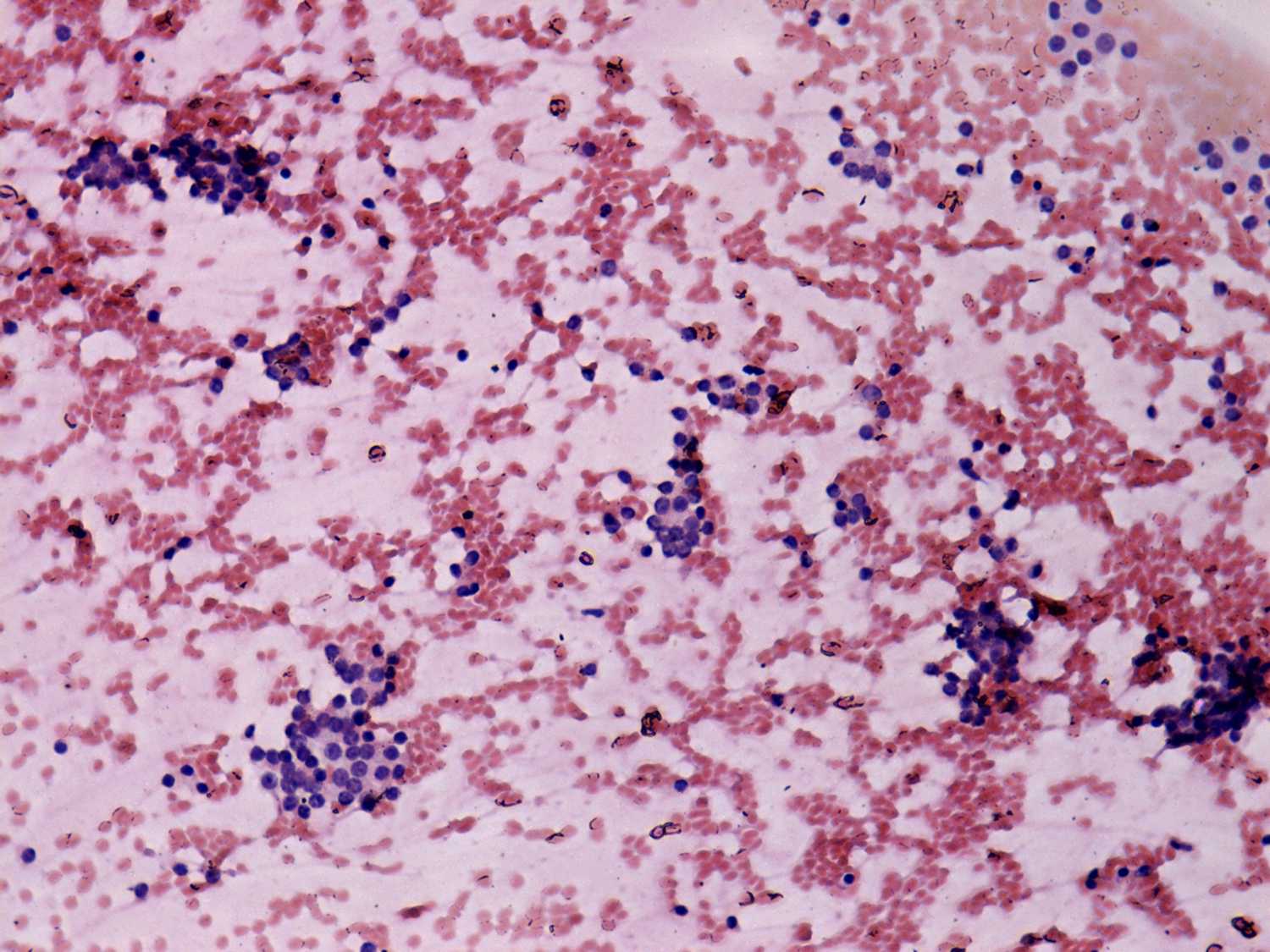 Right lobe, longitudinal scan