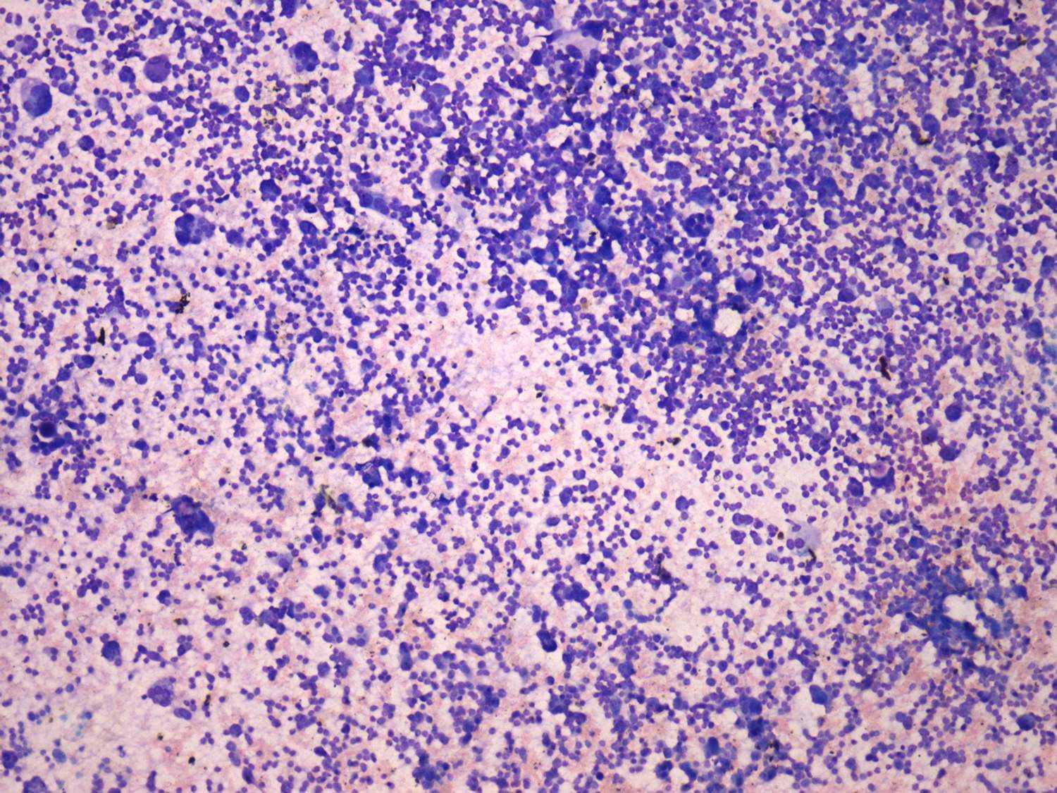 Right lobe, longitudinal scan