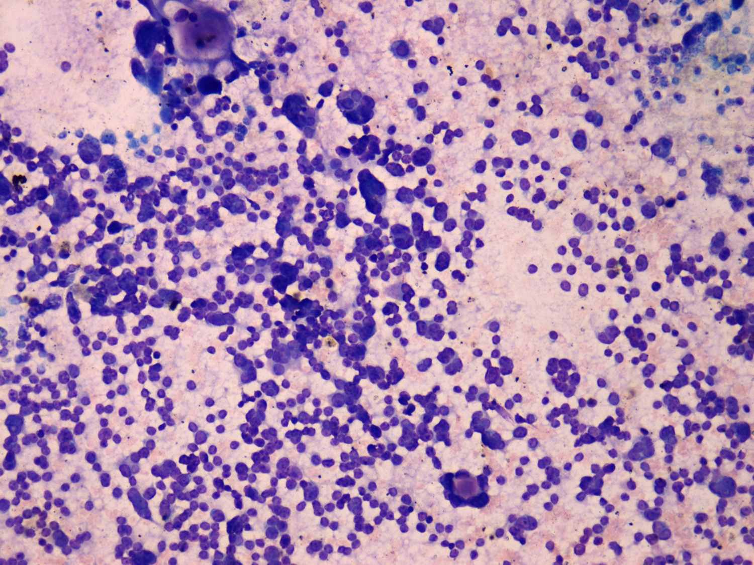 Right lobe, longitudinal scan