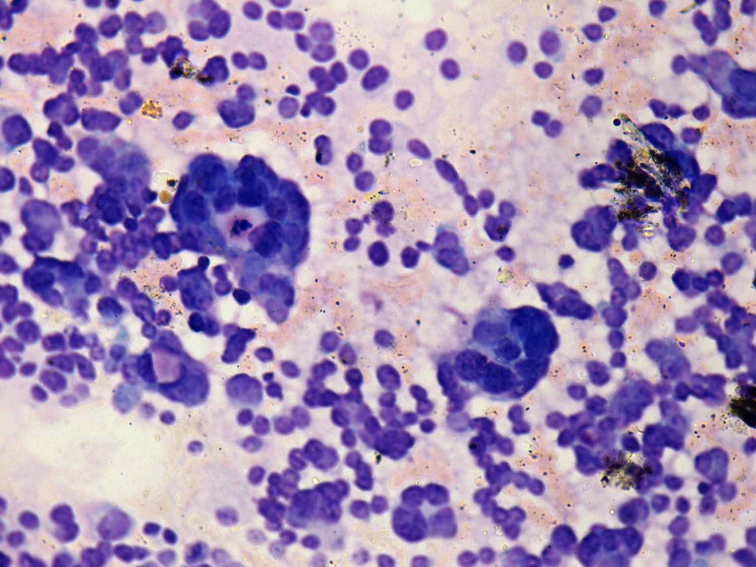 Right lobe, longitudinal scan