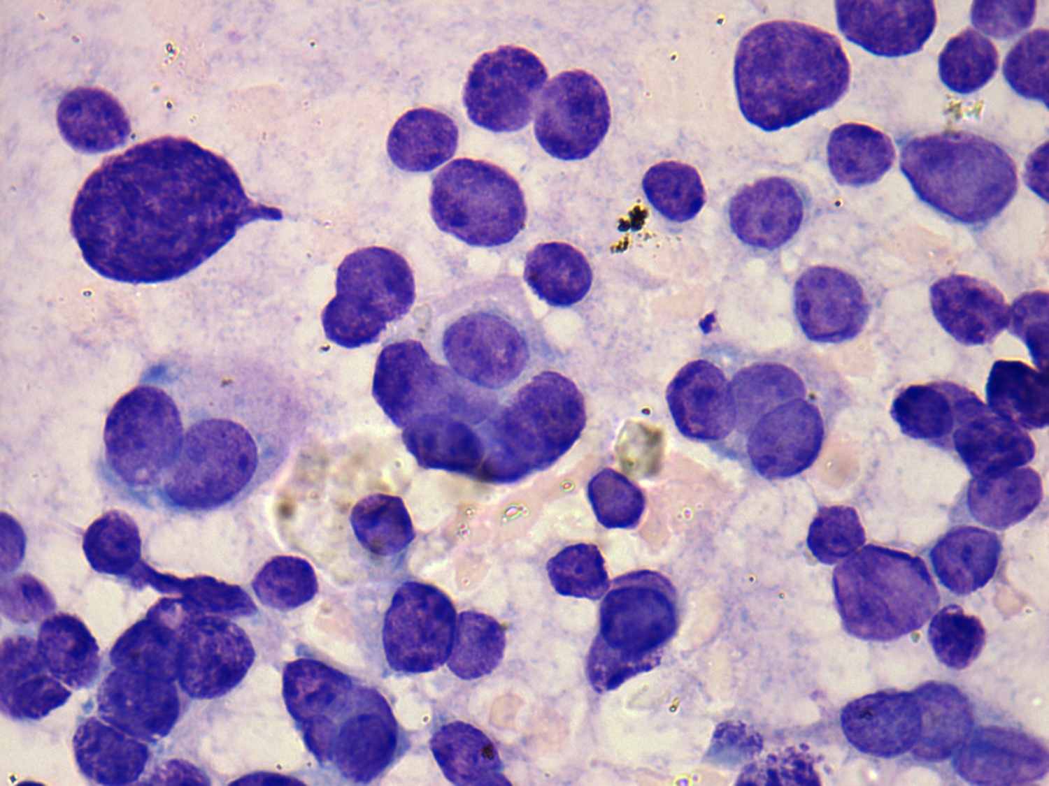 Right lobe, longitudinal scan