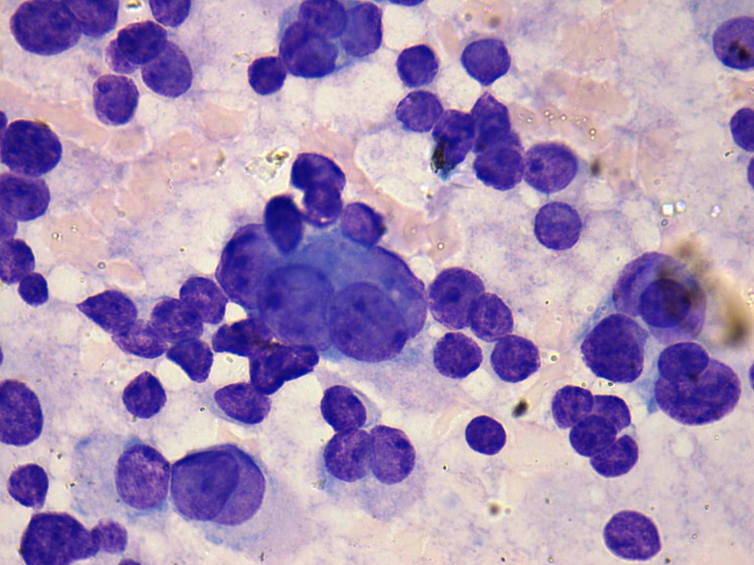 Right lobe, longitudinal scan