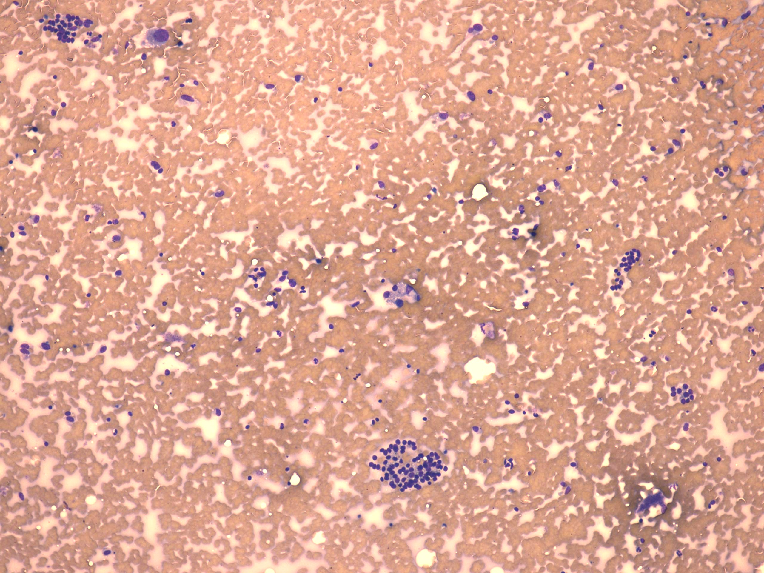 Right lobe, longitudinal scan
