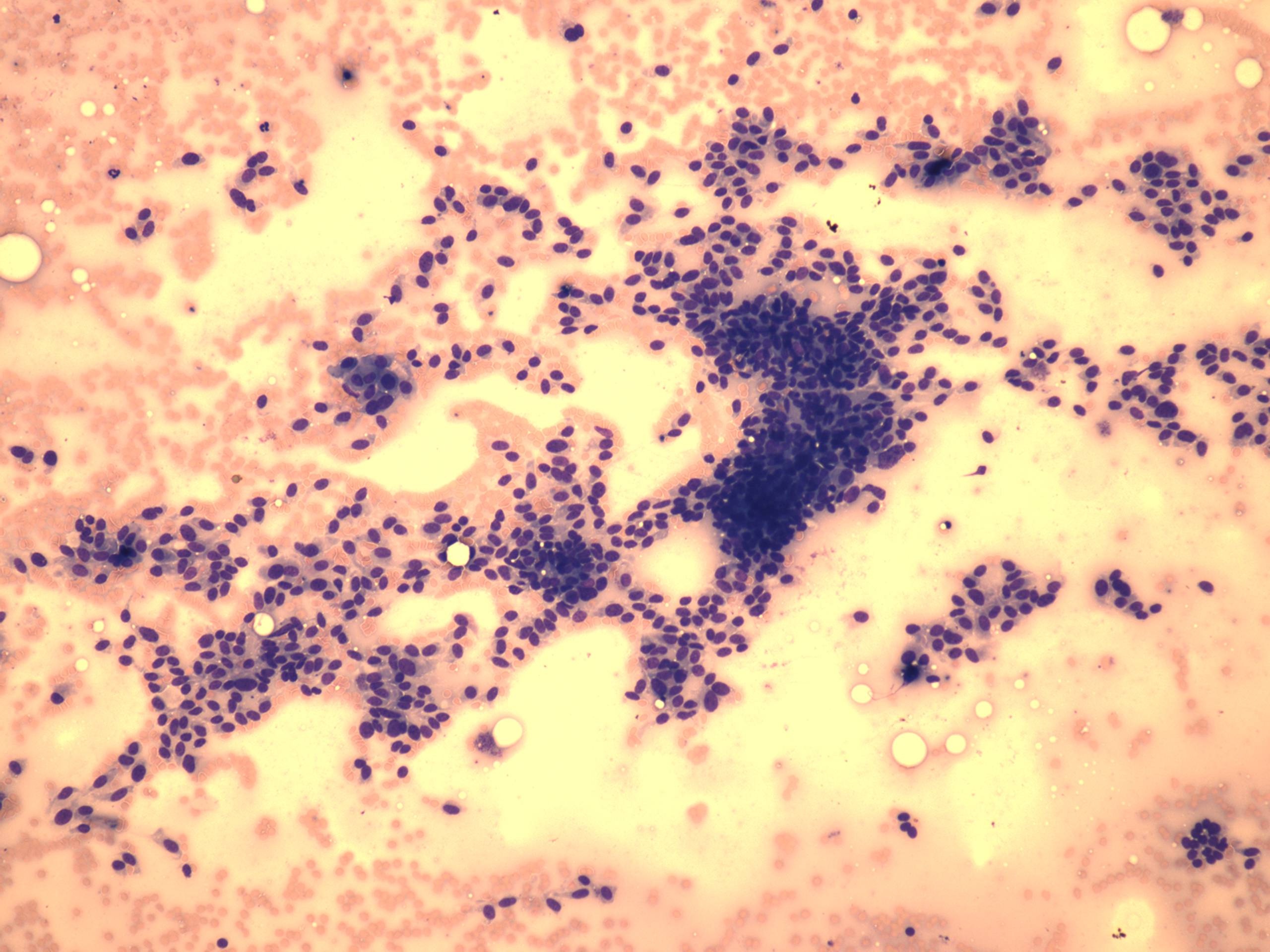 Right lobe, longitudinal scan