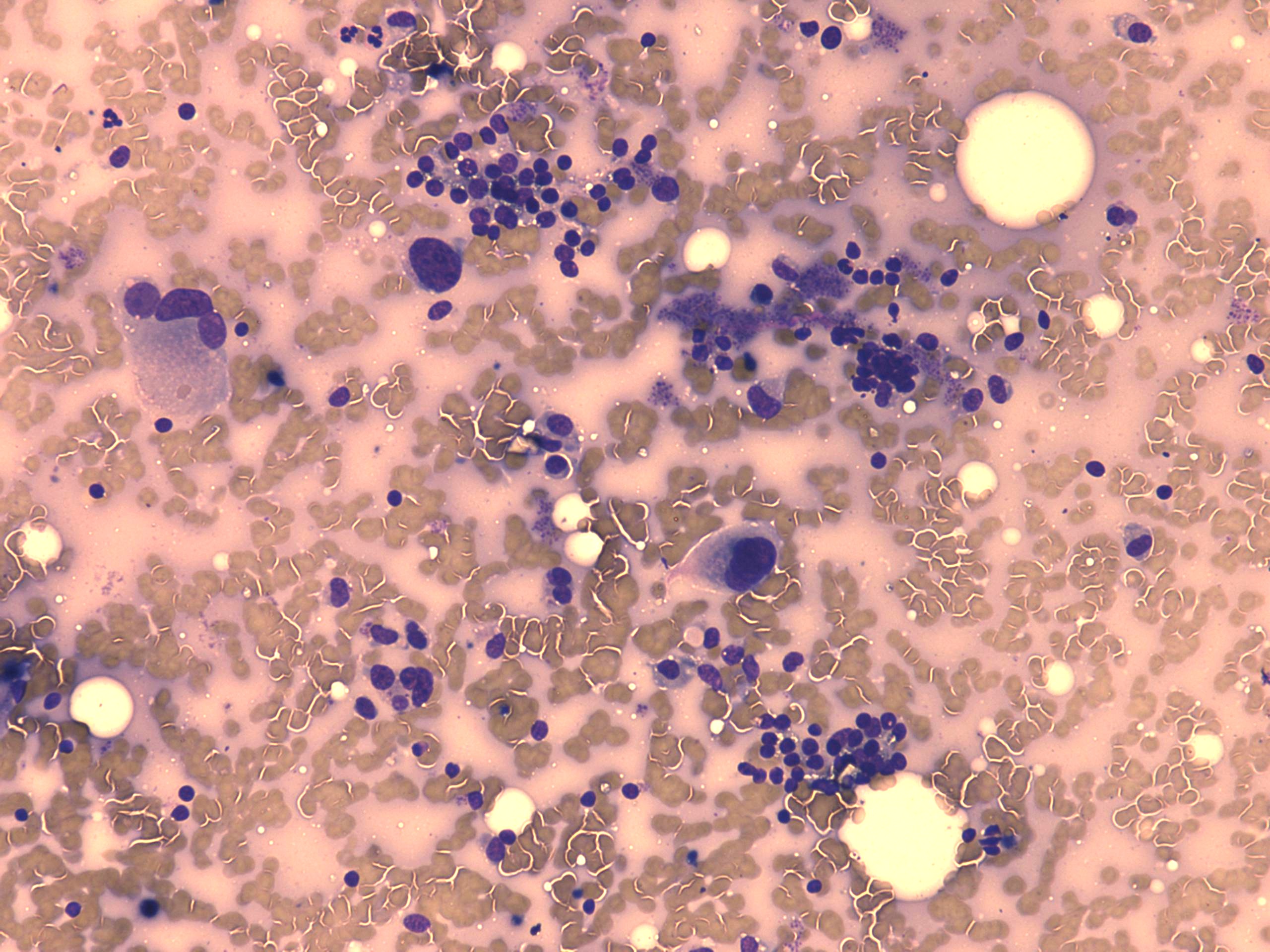 Right lobe, longitudinal scan