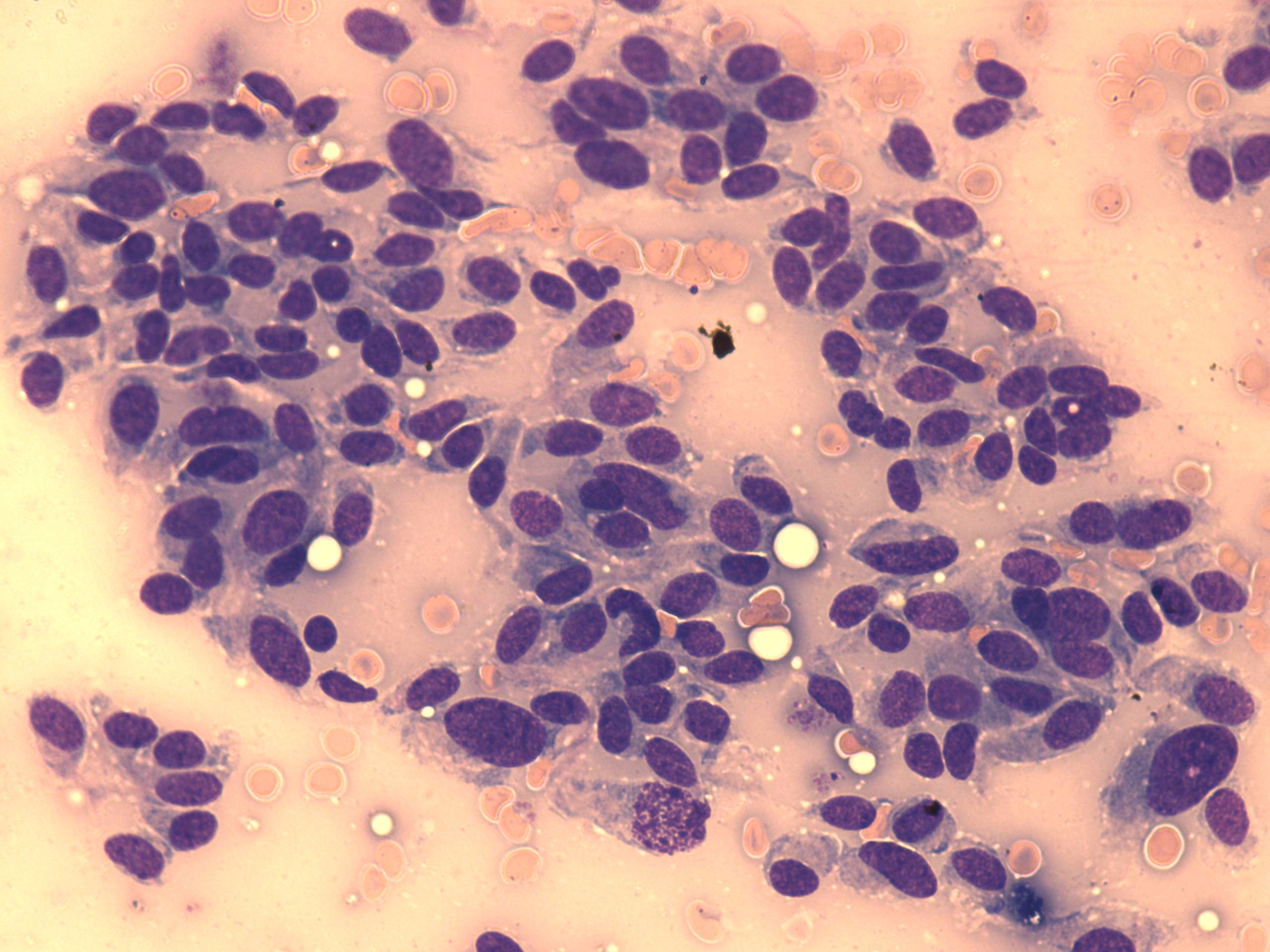 Right lobe, longitudinal scan