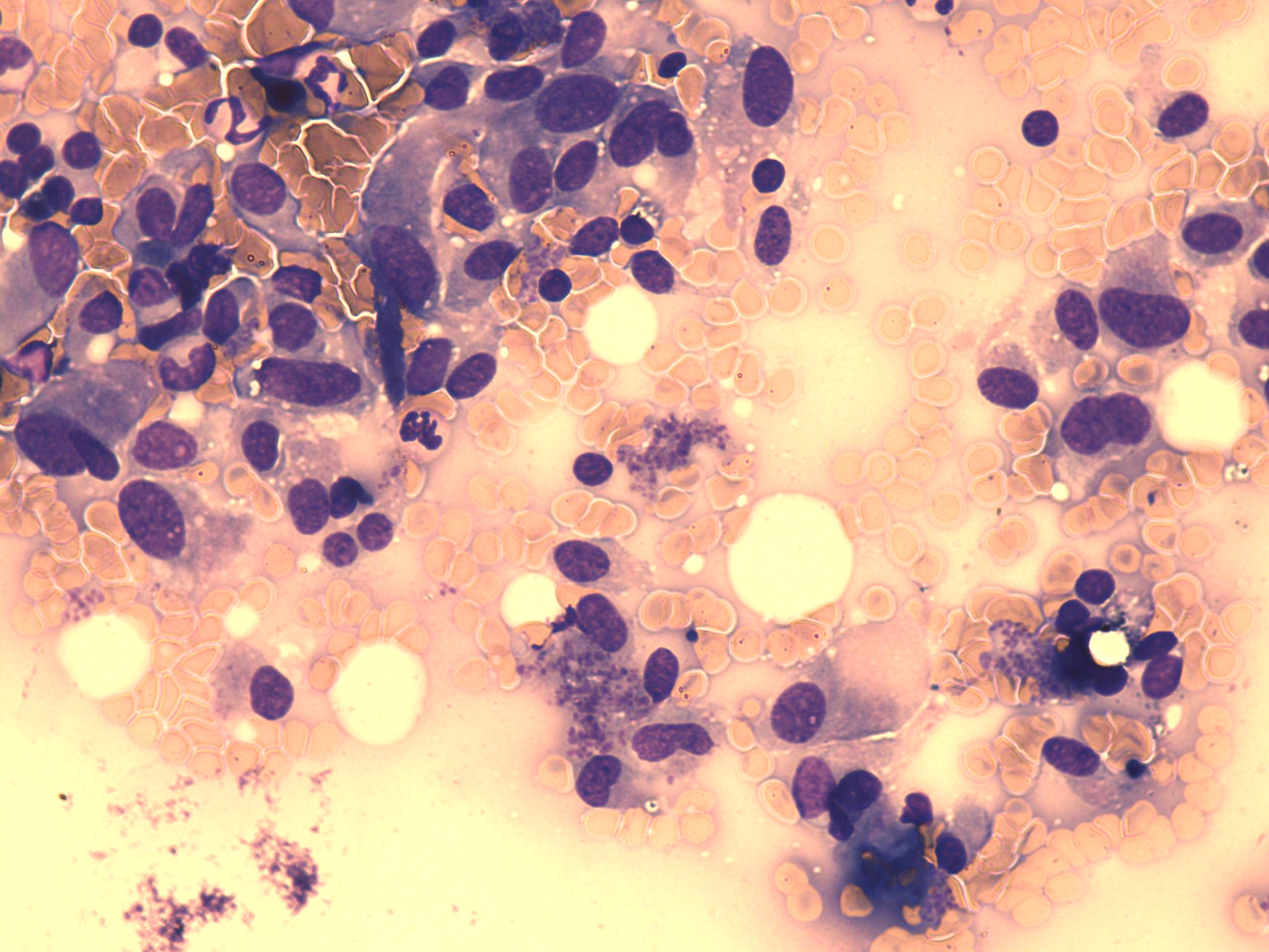 Right lobe, longitudinal scan