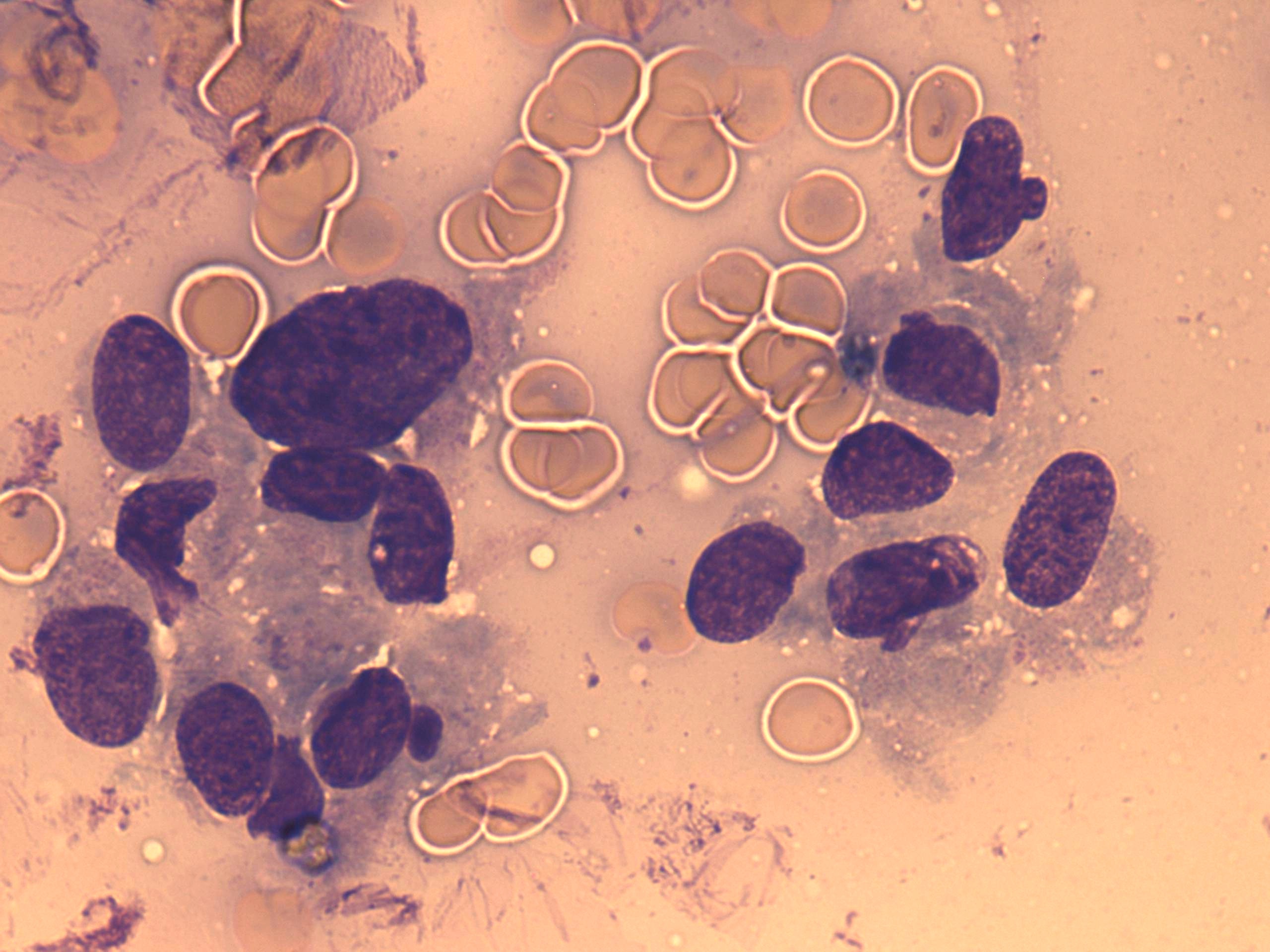 Right lobe, longitudinal scan