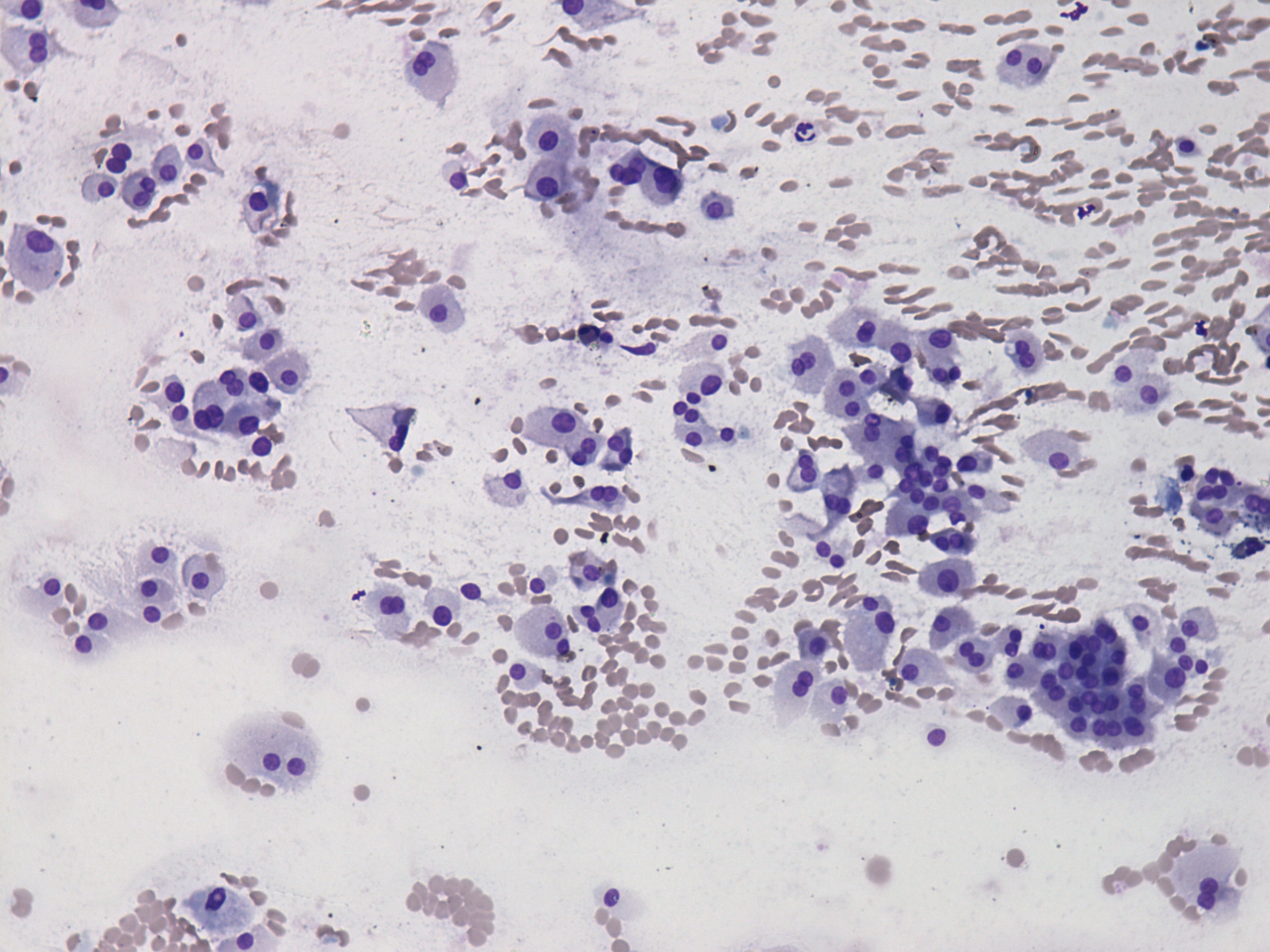 Right lobe, longitudinal scan