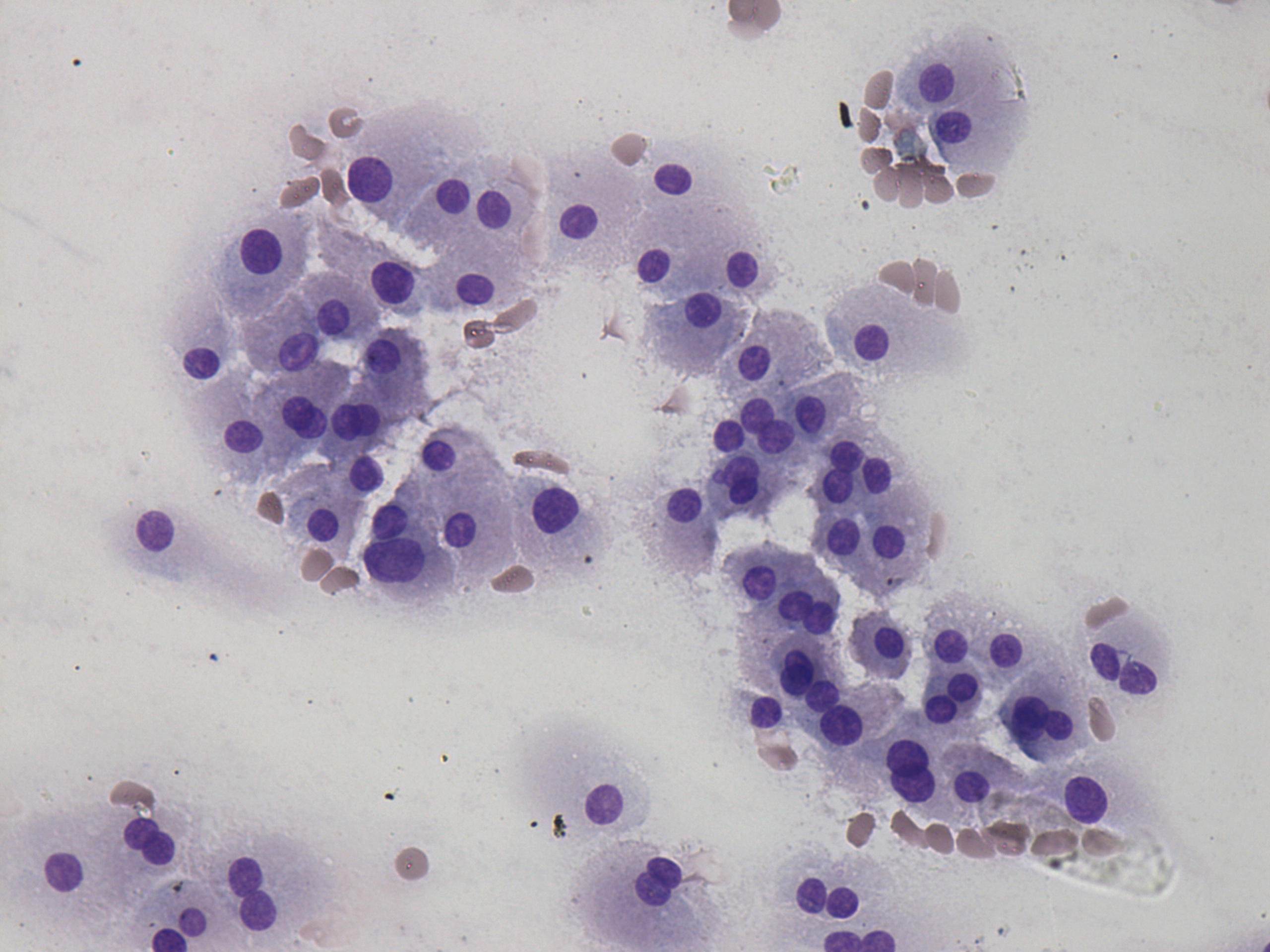 Right lobe, longitudinal scan
