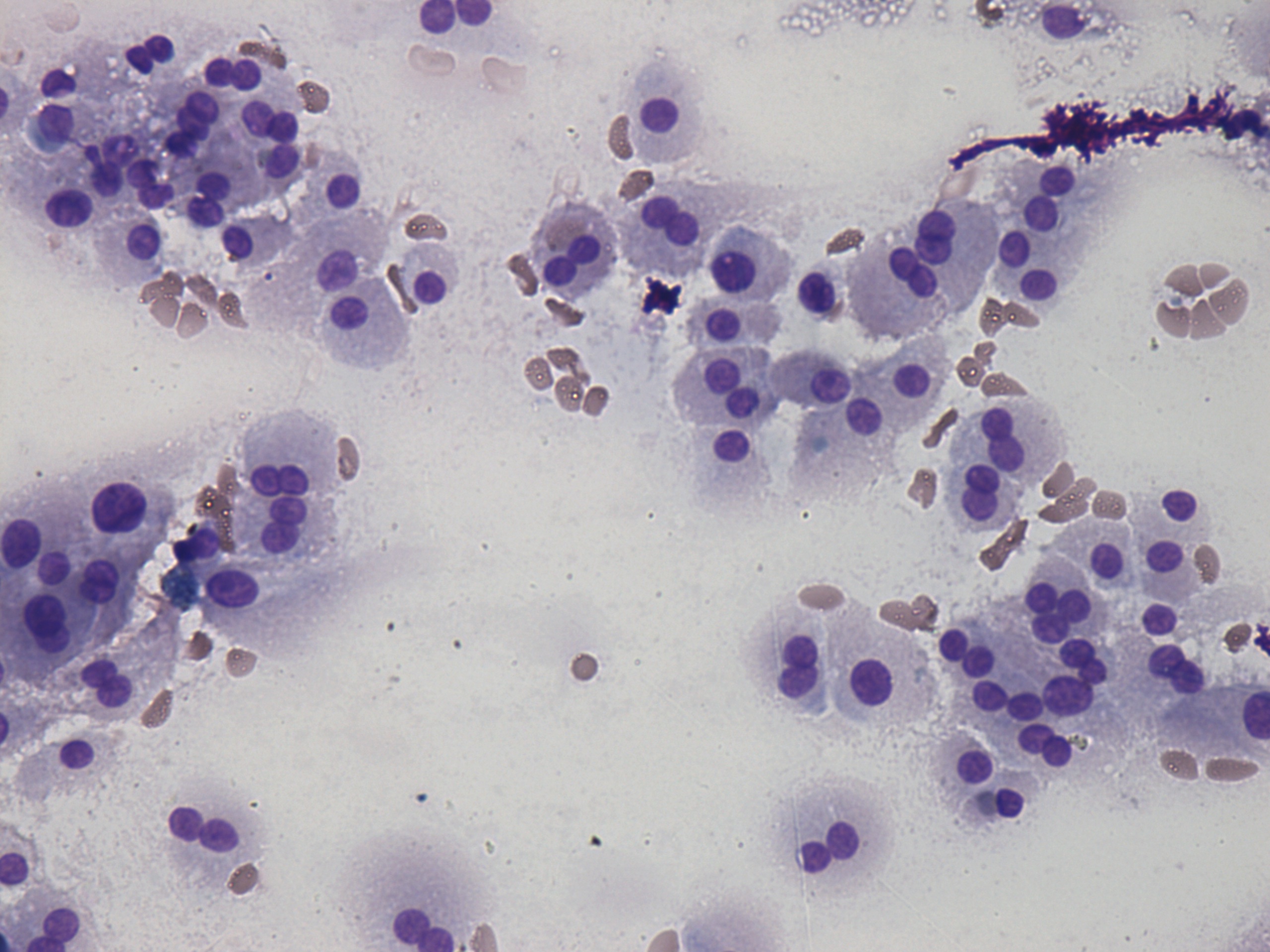 Right lobe, longitudinal scan