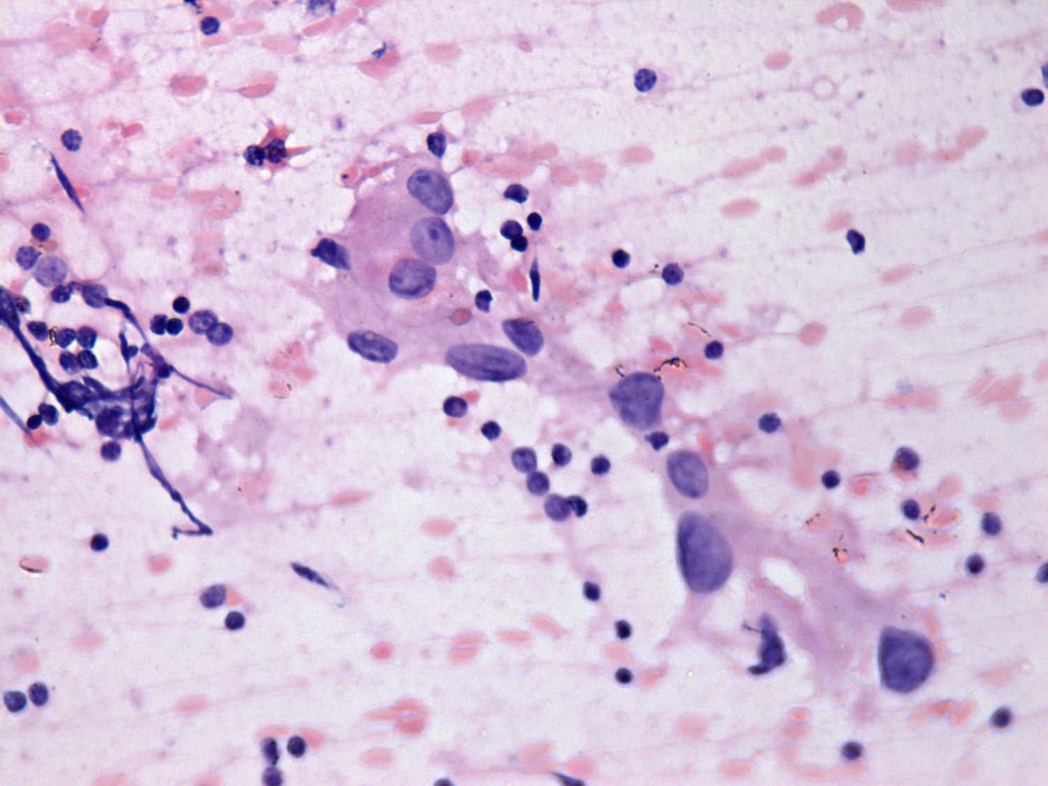 Right lobe, longitudinal scan