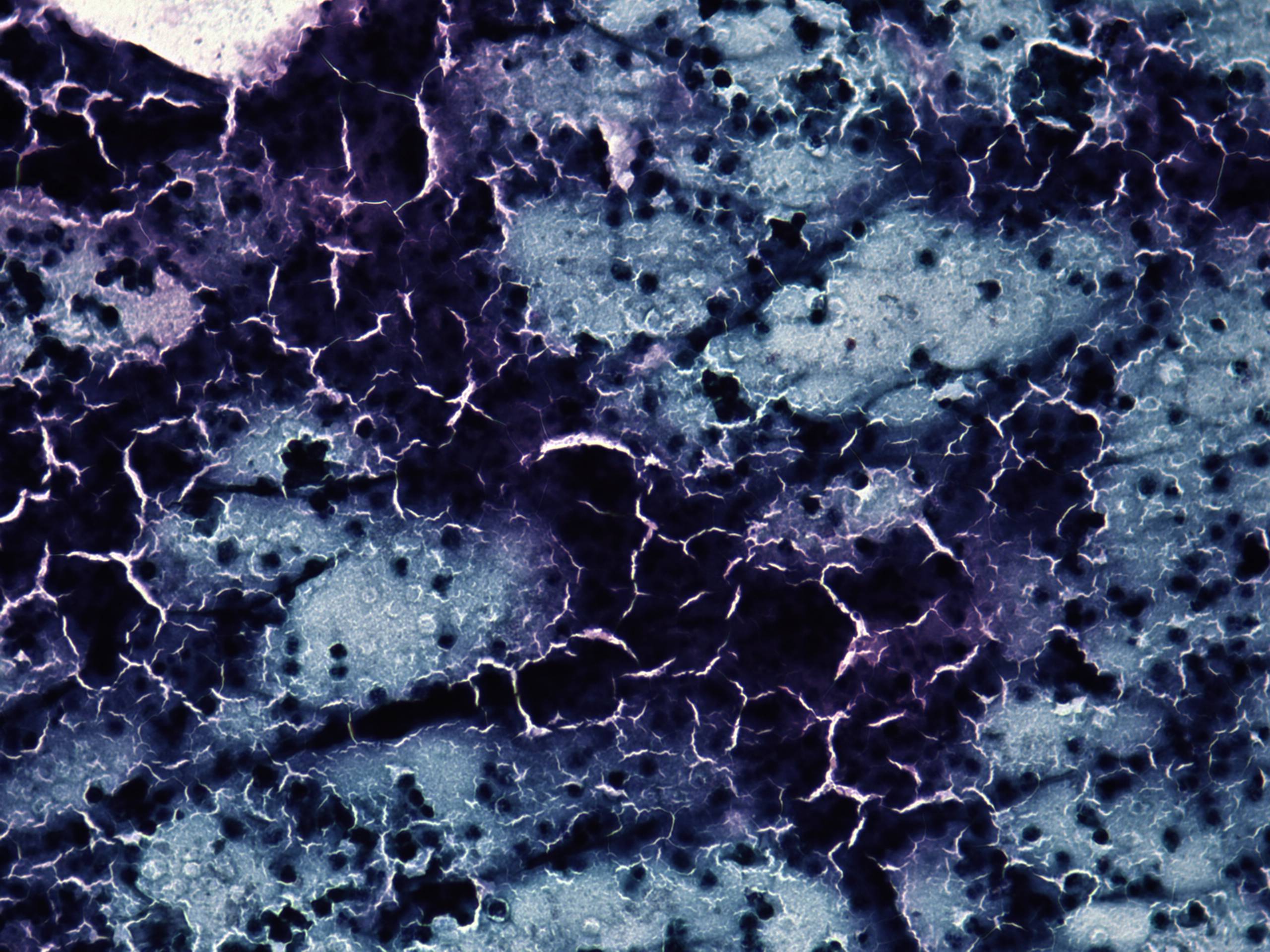 Right lobe, longitudinal scan