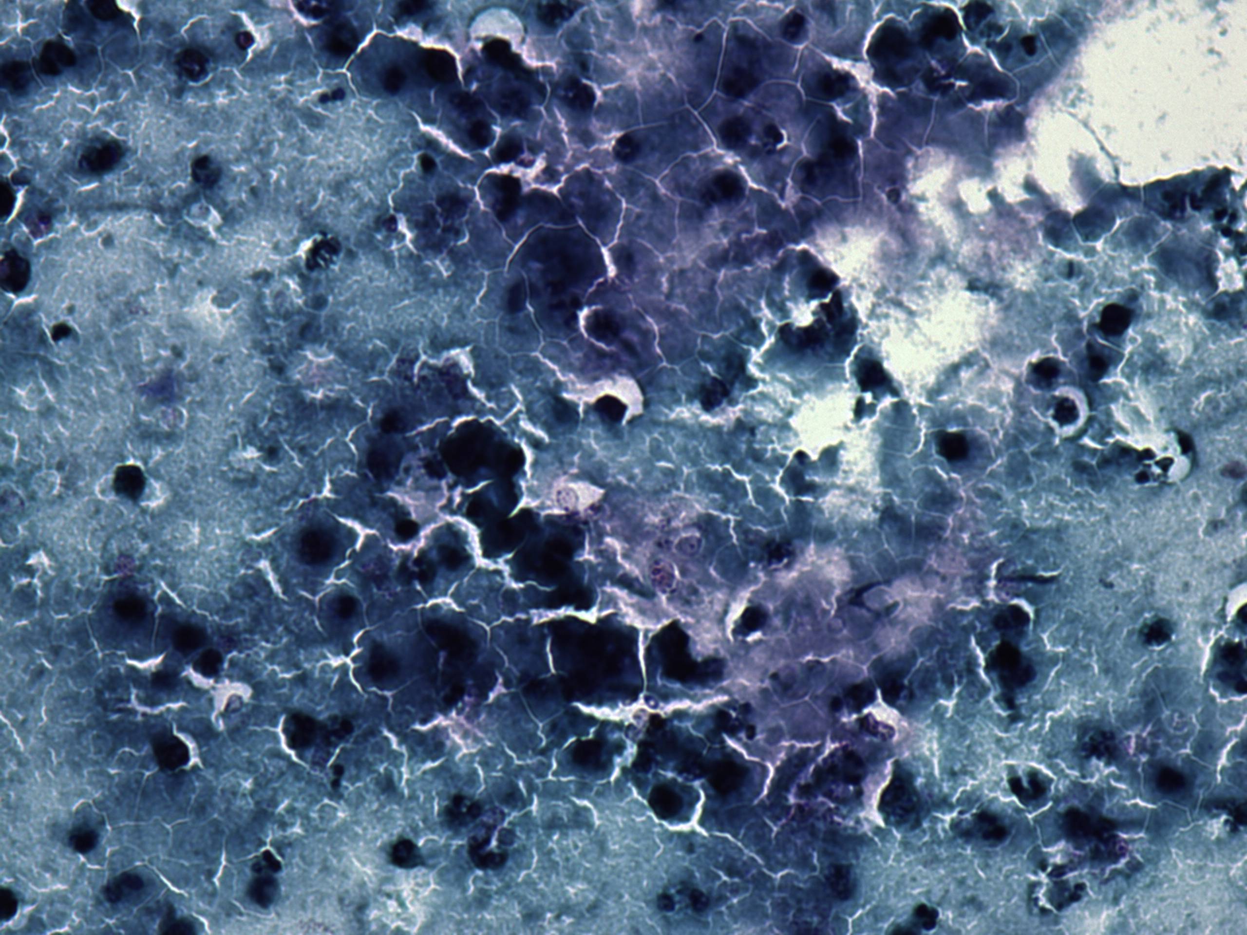 Right lobe, longitudinal scan